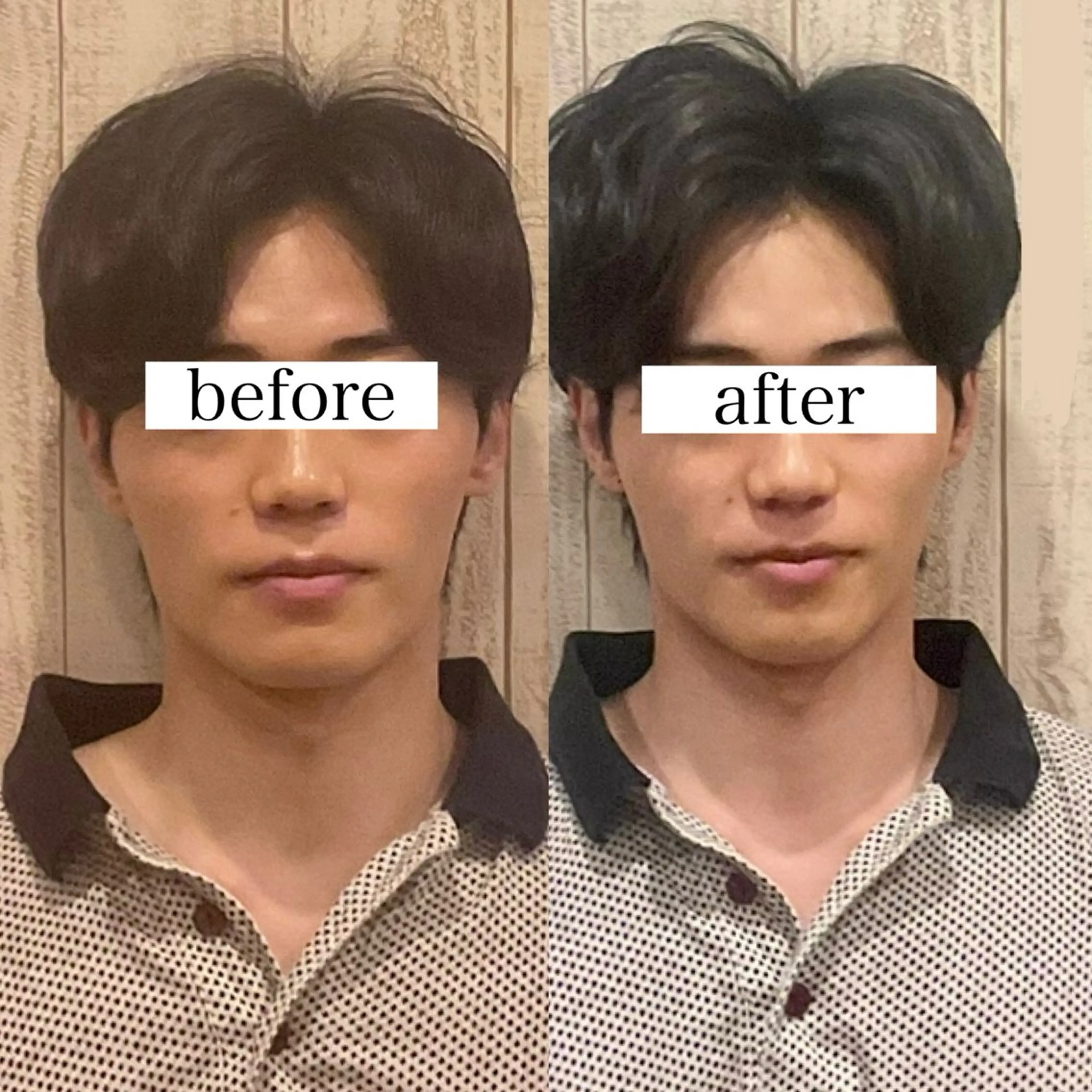 【メンズ限定💆‍♂️】立体美顔&ツルスベ肌💫小顔矯正ハイドラフェイシャルで垢抜け《毛穴洗浄/ニキビ/肌荒れ/乾燥》の写真