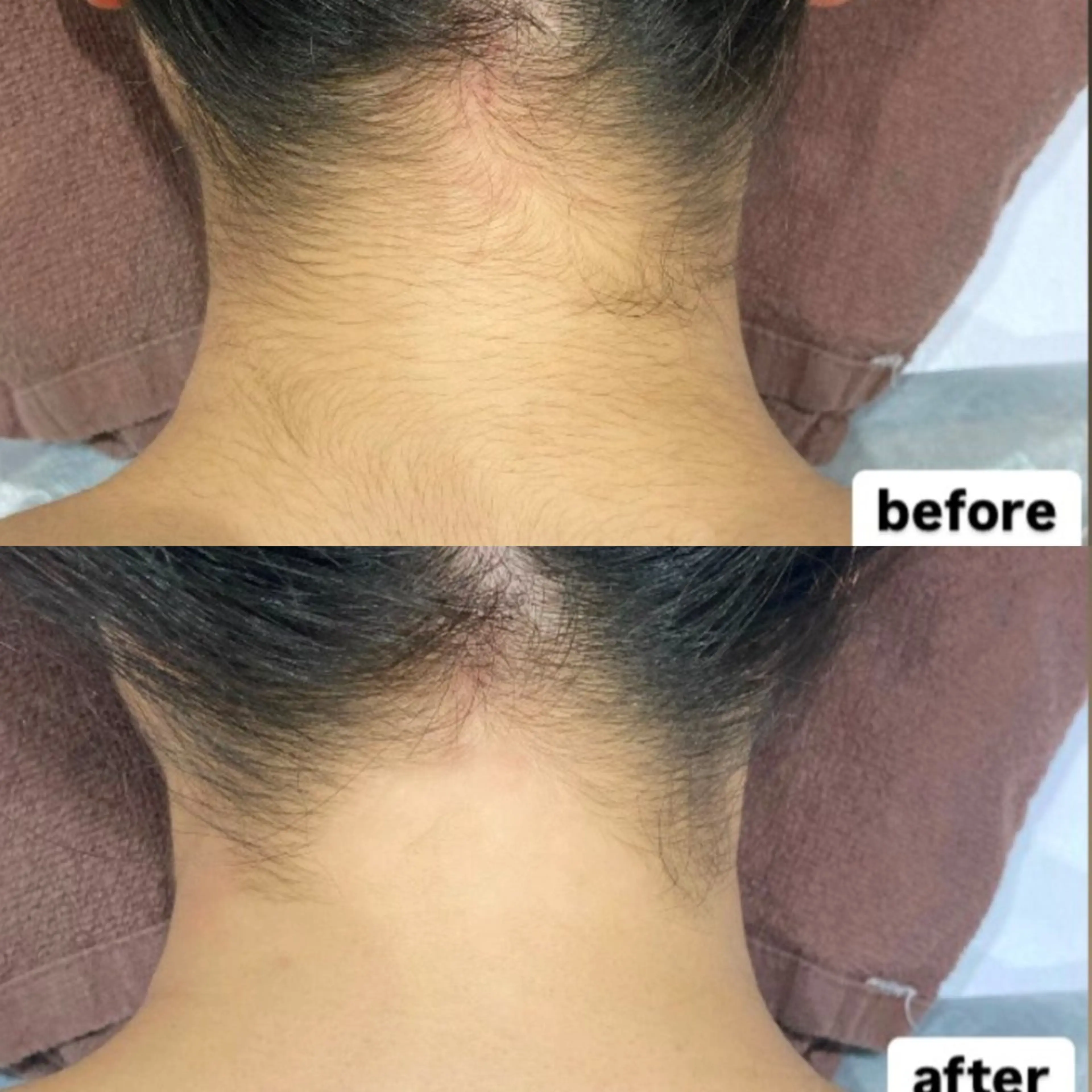 脱毛 DahliaBeauty ダリアビューティー所属・DahliaBeau tyフェイシャル中村のエステ・リラクイメージ