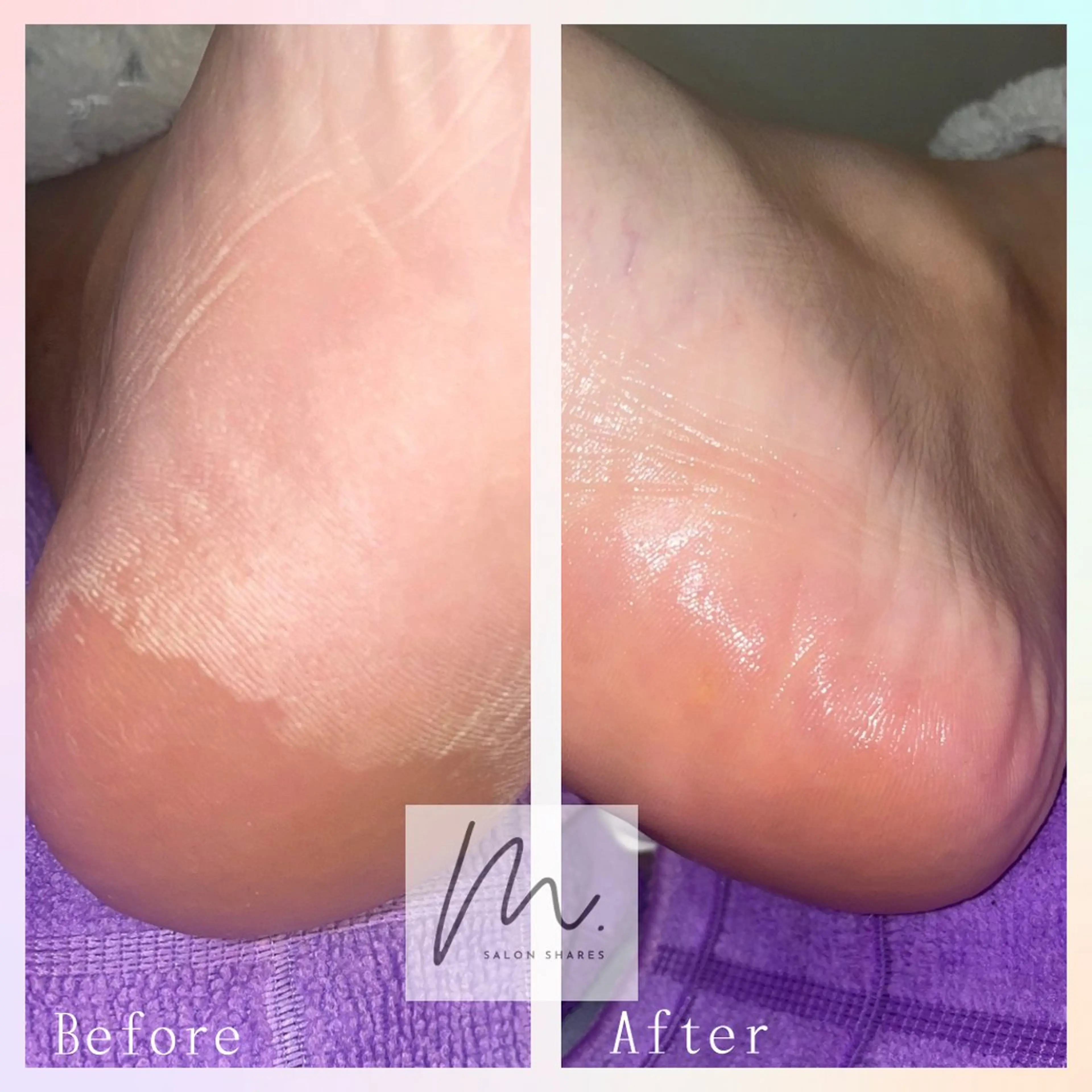 SHARES MADOKAのエステ・リラクイメージ