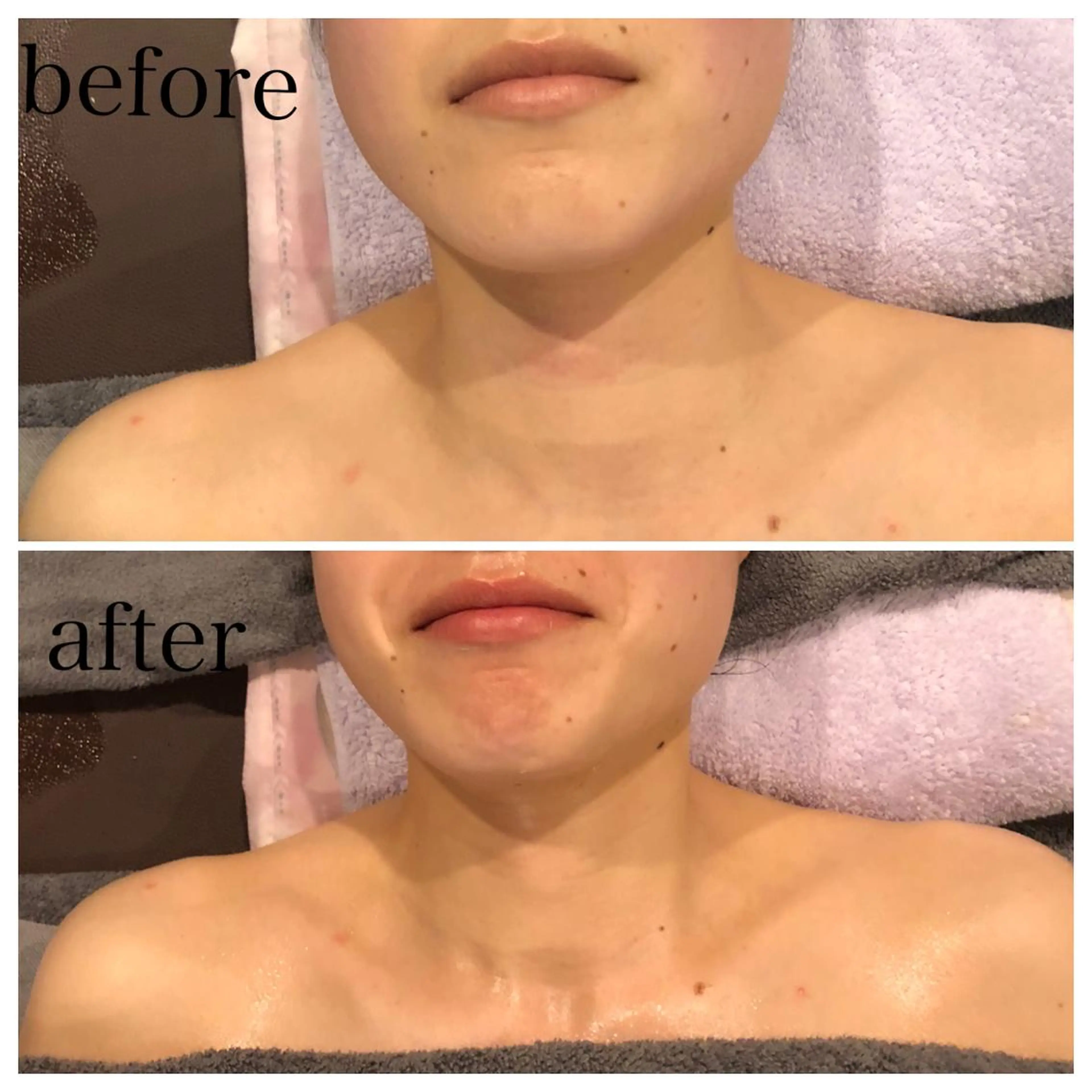 ロング カラー パーマ ヘアアレンジ メンズ キッズ ネイル マツエク・マツパ アイブロウ SALON SINCERITEのエステ・リラクイメージ