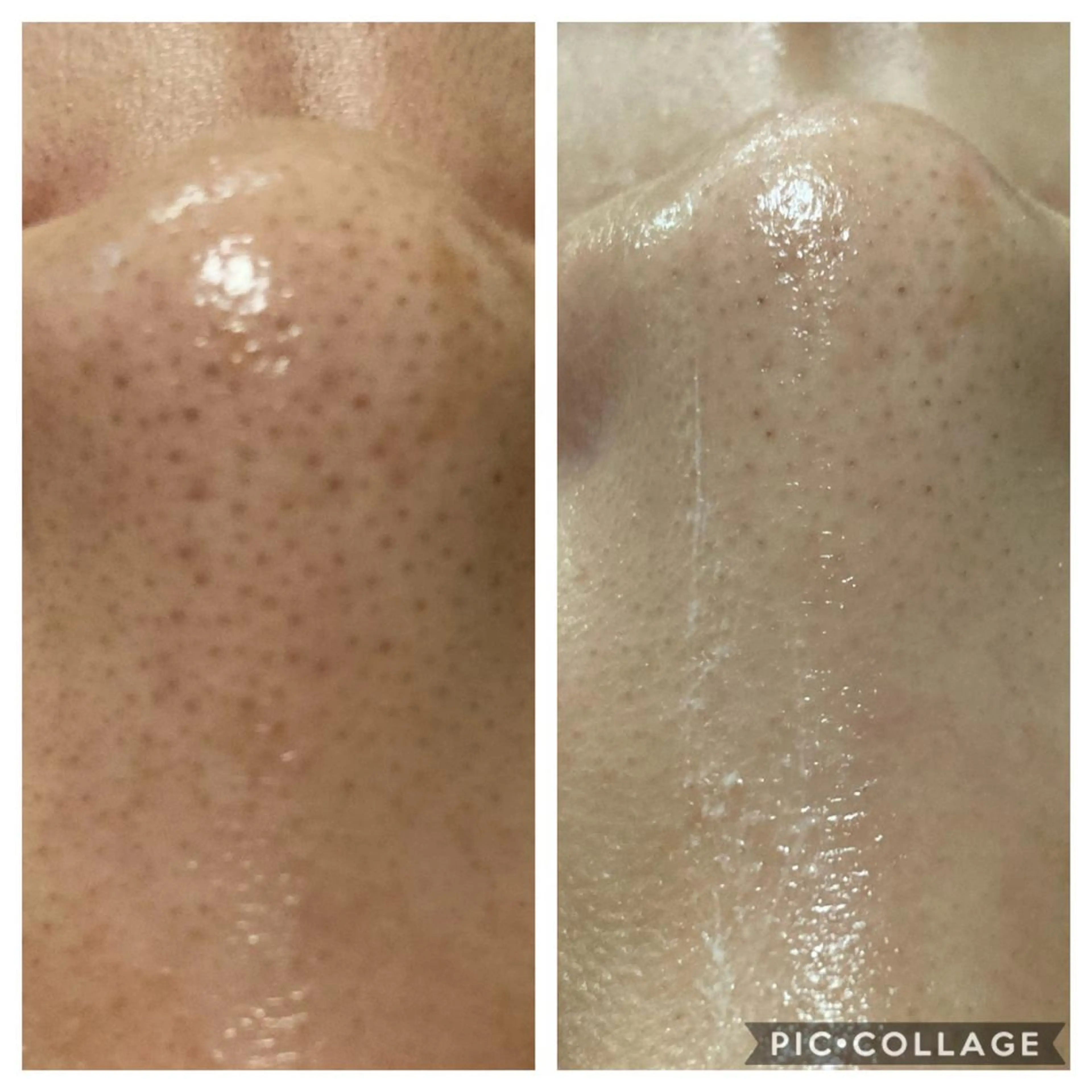 ハーブピーリング 専門／今榮麻美のエステ・リラクイメージ