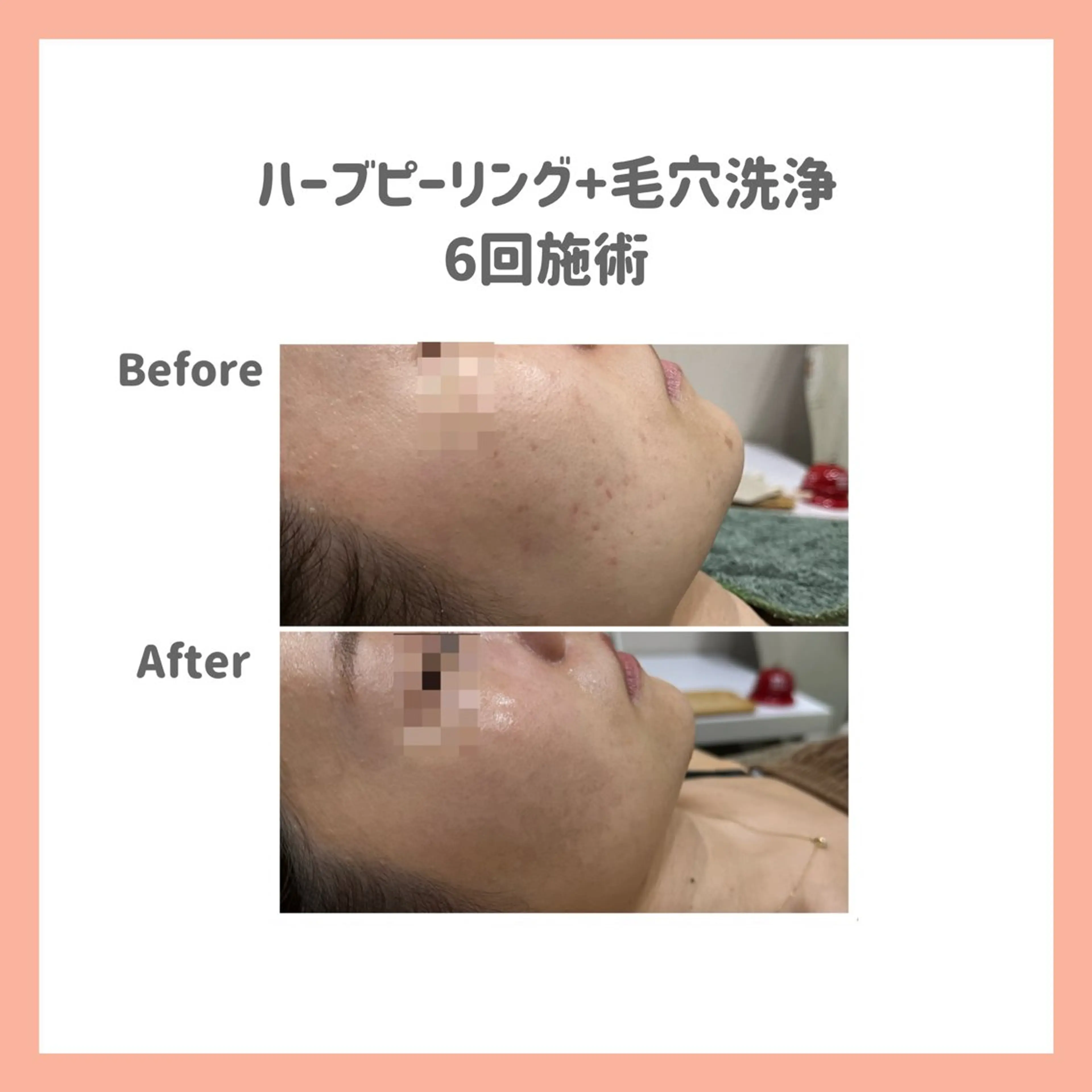 ハーブピーリング専門 muro.のエステ・リラクイメージ