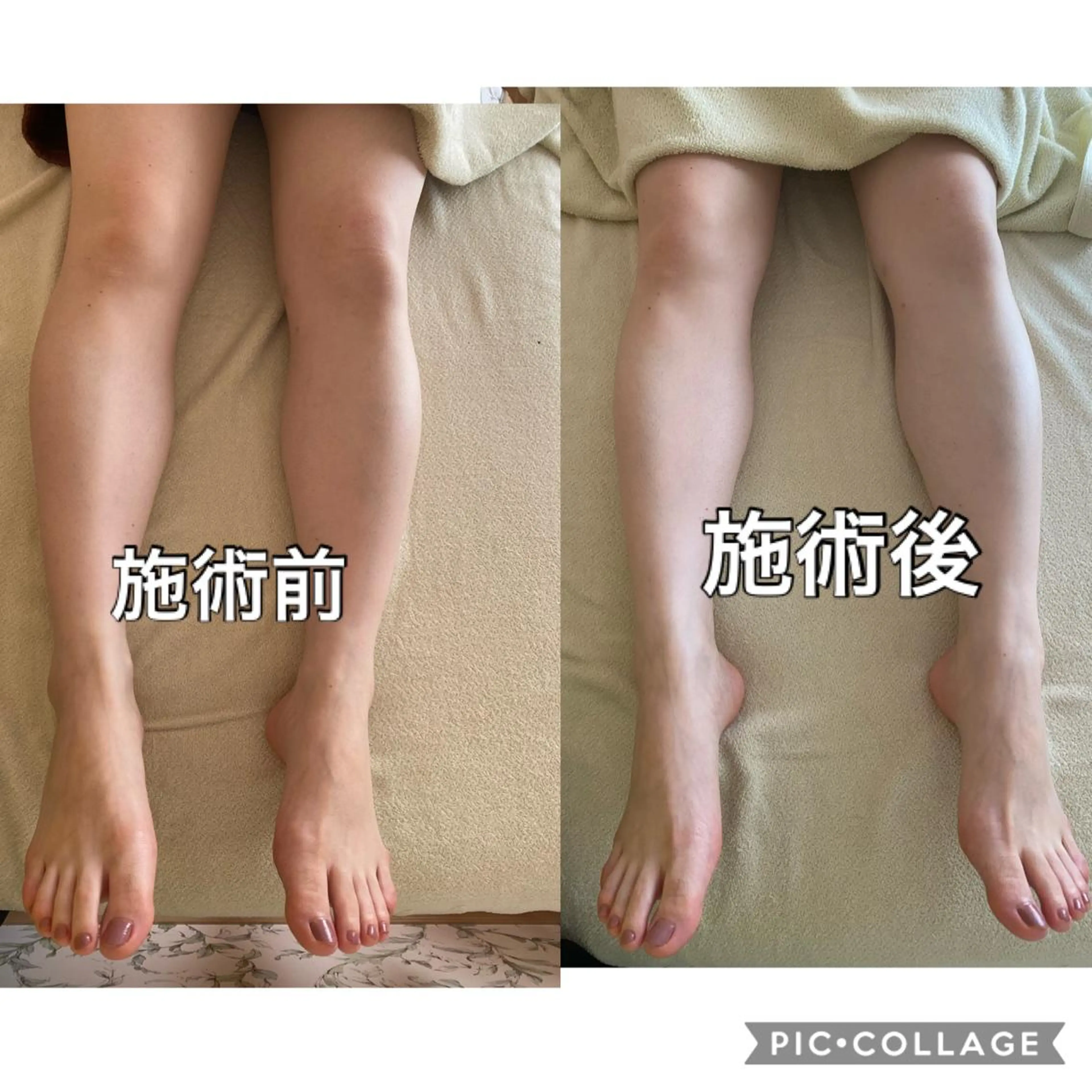 足痩せフットリンパ&ドライヘッドスパの写真