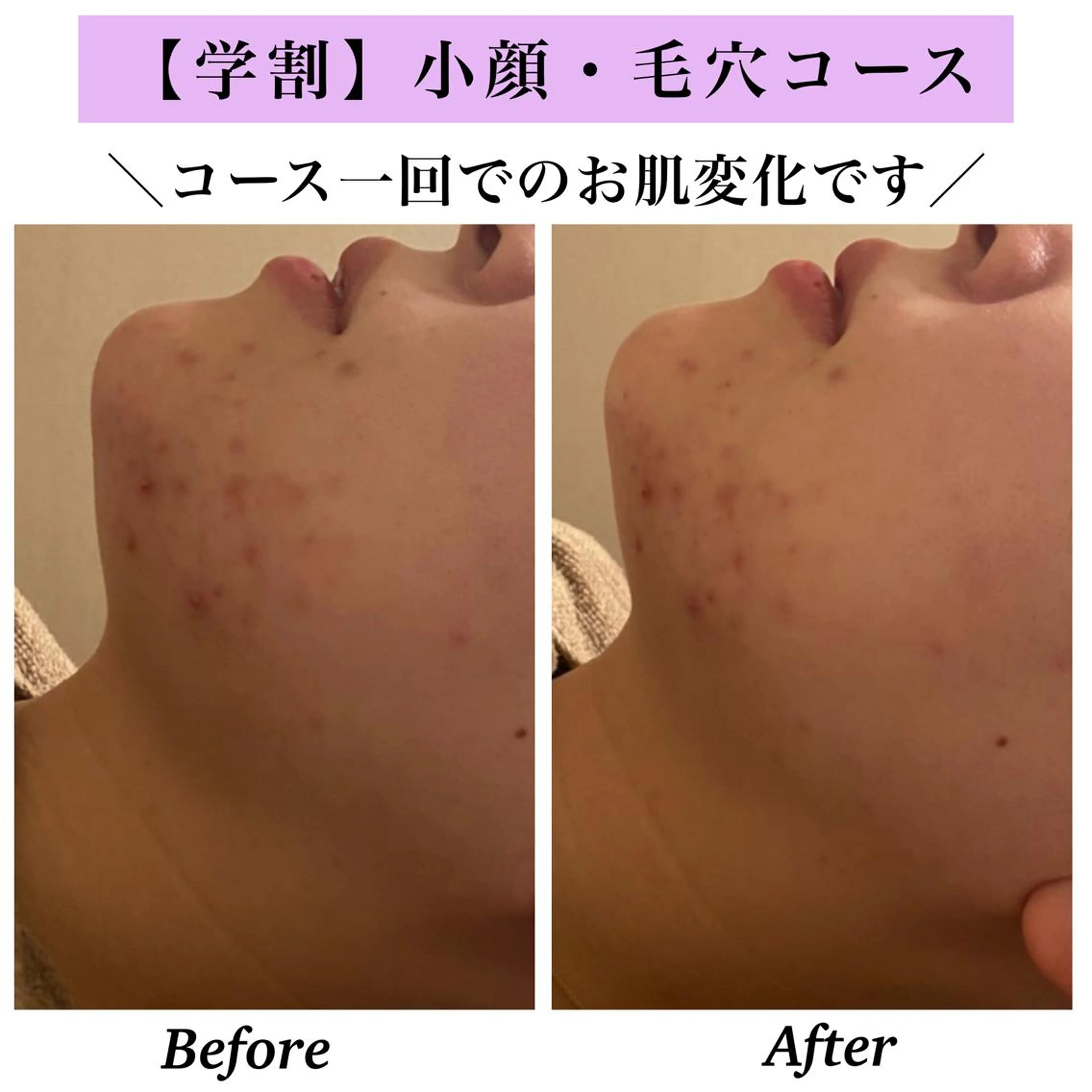 Bellesthe （ベルエステ）のエステ・リラクイメージ