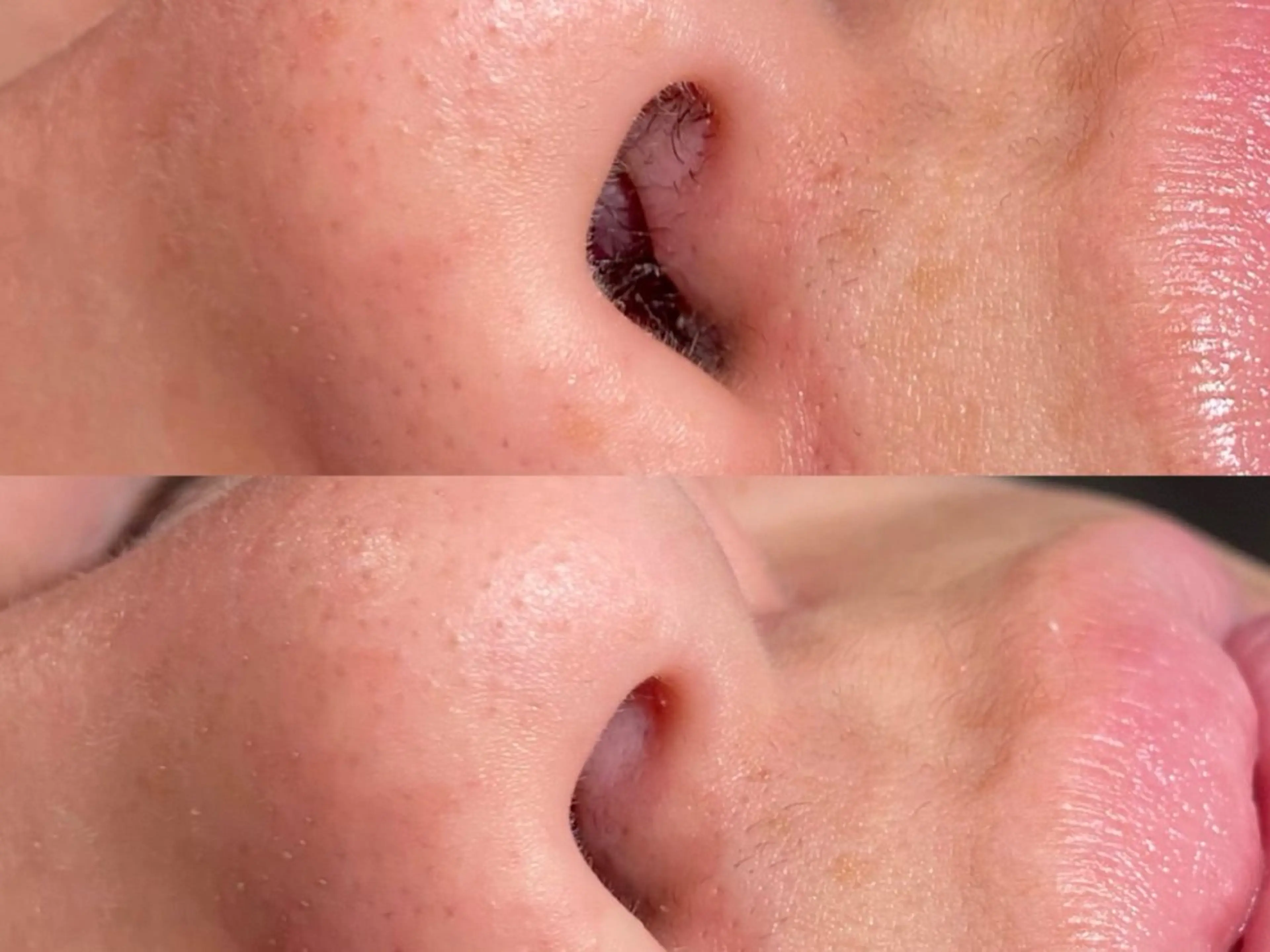 【男性大人気】ミニモ特別価⭐️眉毛スタイリング+鼻毛ワックス¥9900→7600 【ワックス脱毛/骨格診断】の写真