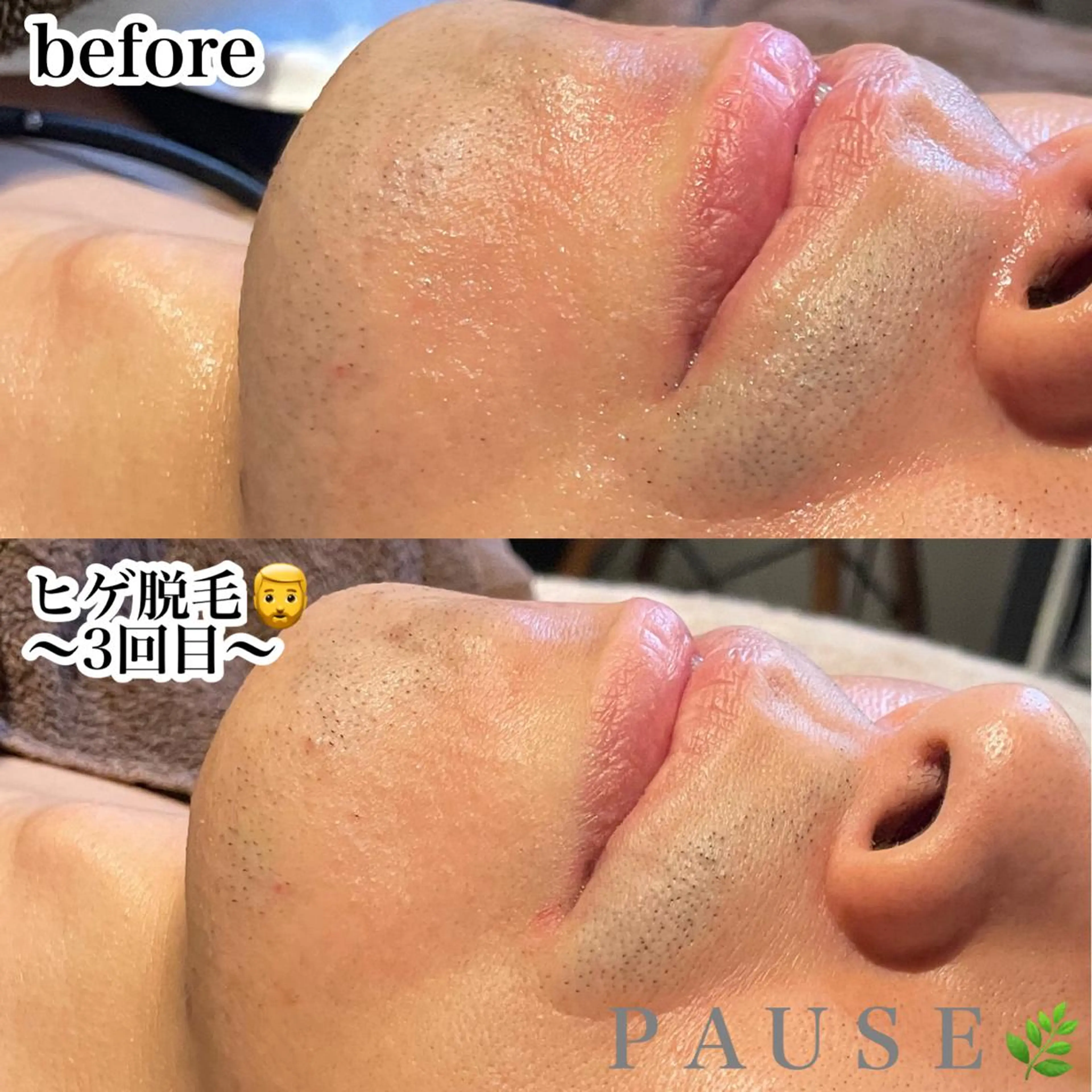 脱毛 浜野 恵美のエステ・リラクイメージ