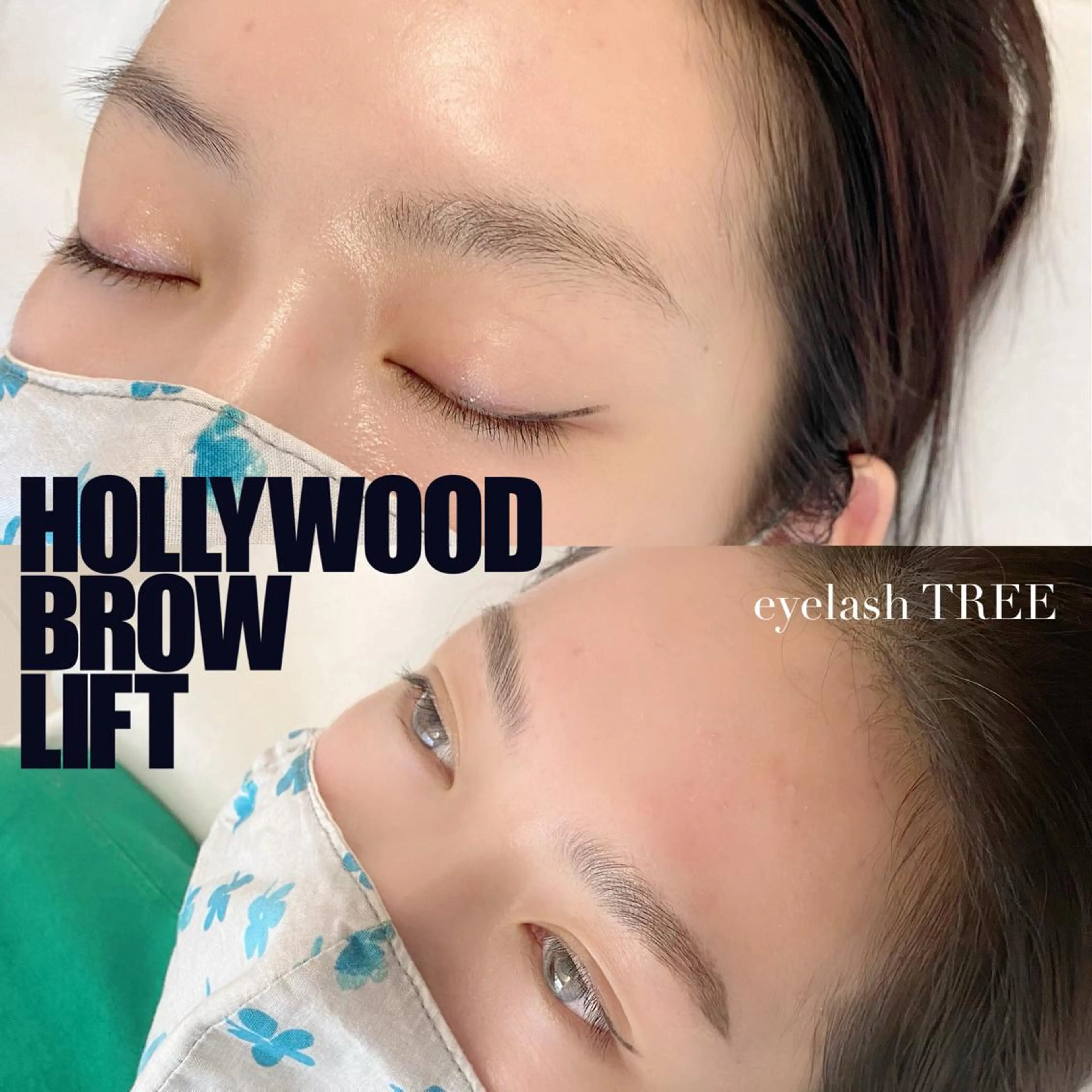 マツエク・マツパ まつげ、毛穴 TREEのエステ・リラクイメージ