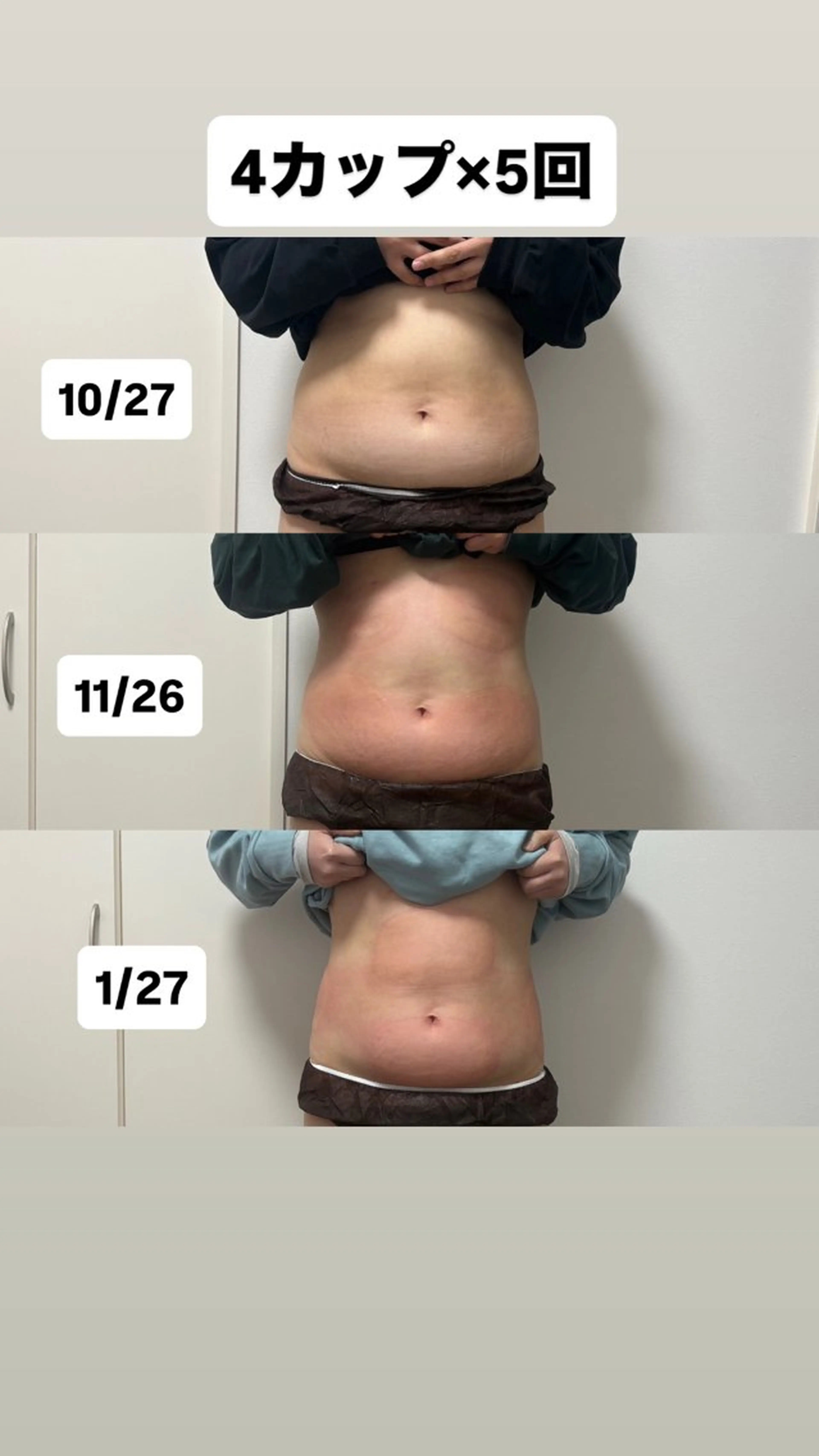 エステ Miiju.所属・Miiju. 石巻市 脂肪冷却  鈴木のエステ・リラクイメージ