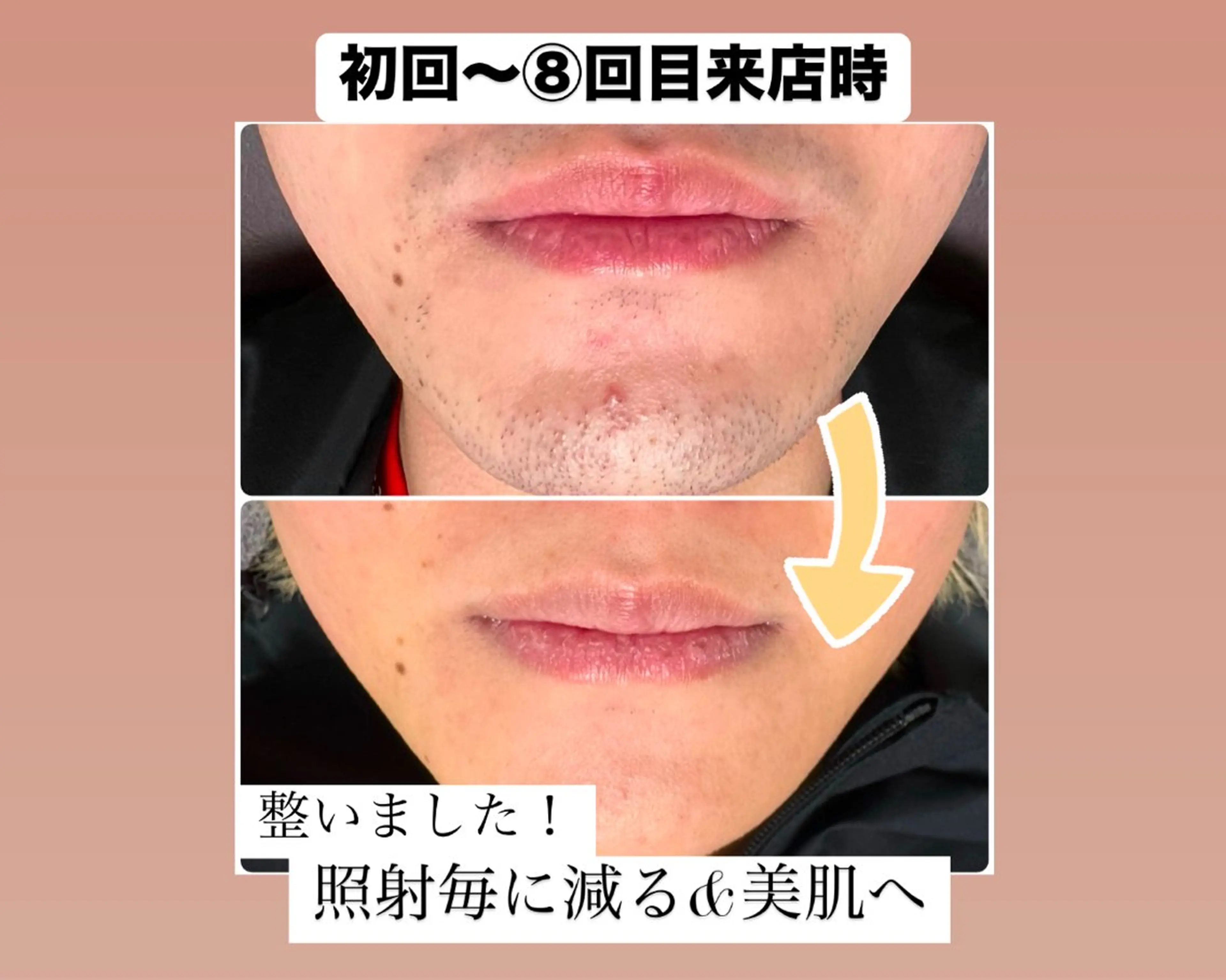 メンズ 脱毛 メンズ脱毛サロン Le falcoのエステ・リラクイメージ