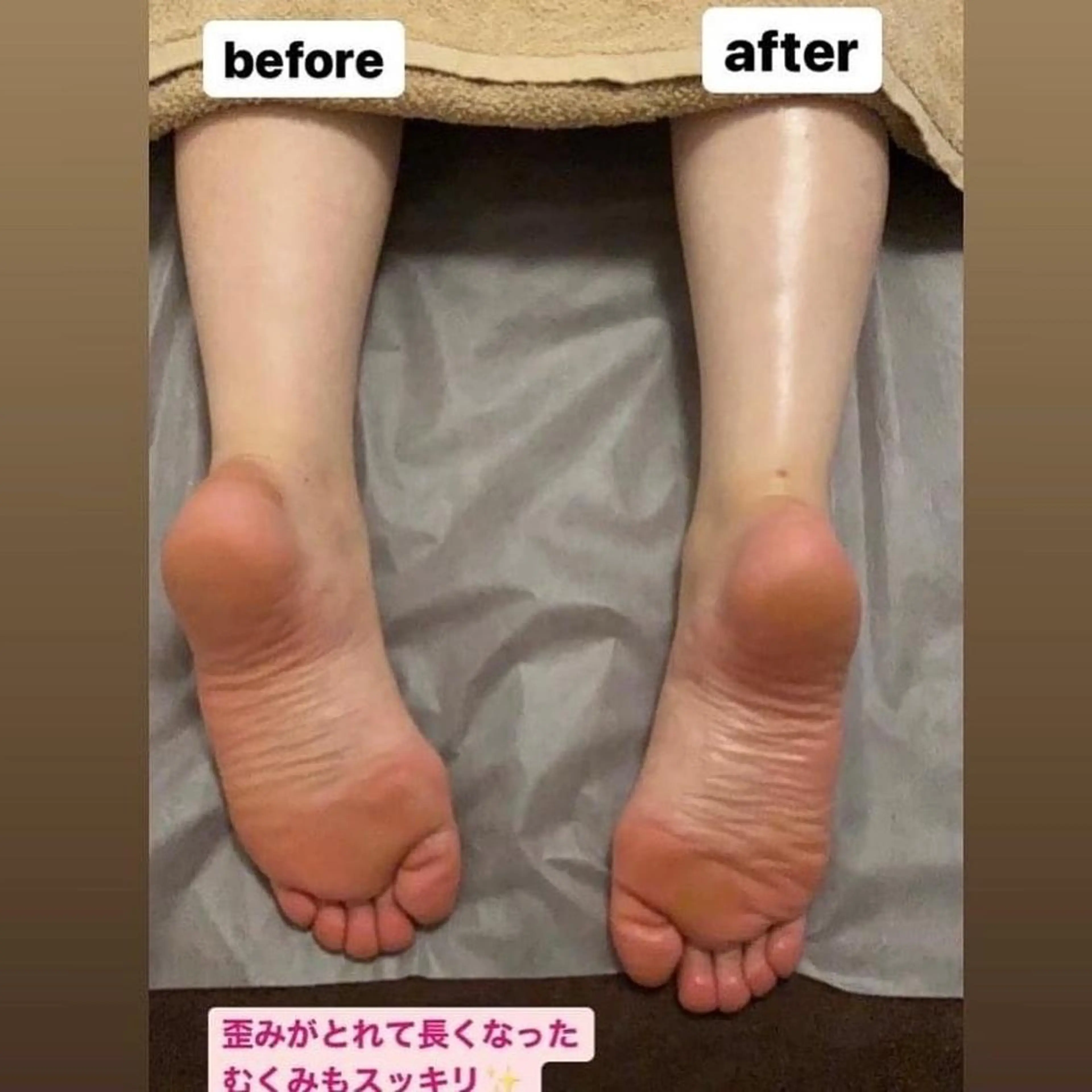 【ボディ】痩せやすい身体に変える痛くない筋膜リリースの写真