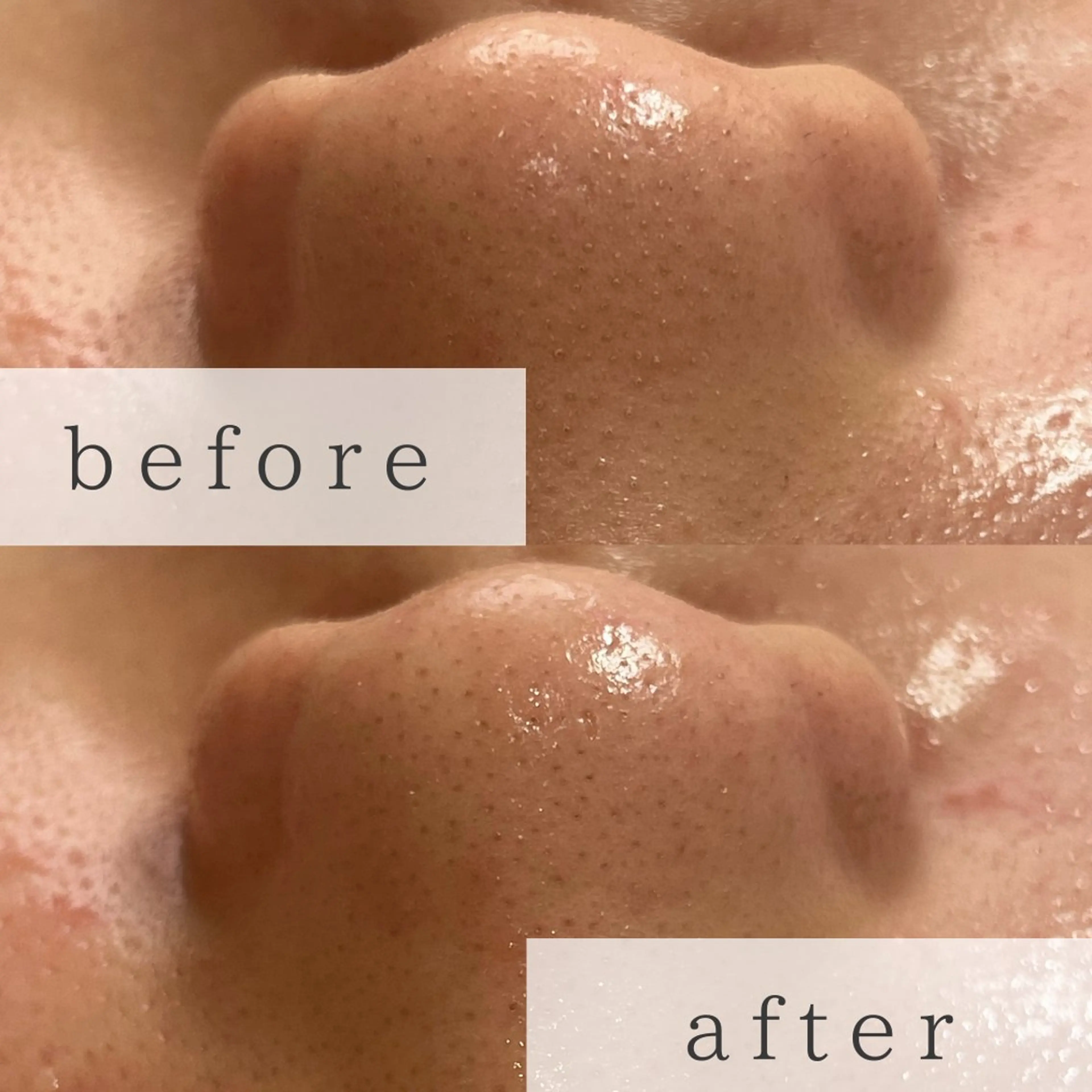 yokohama 🎀miaのマツエク・マツパデザイン