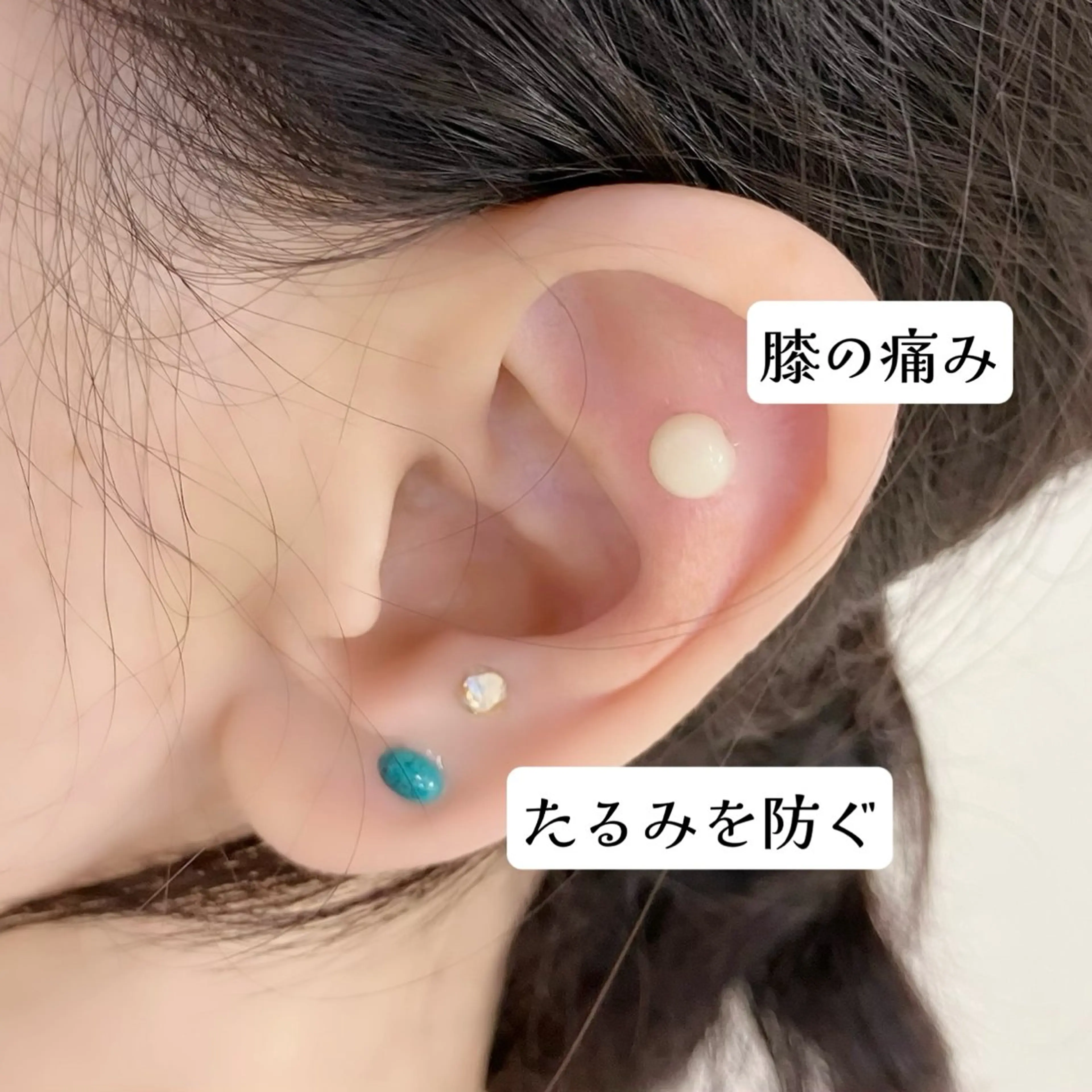 その他 S LOUNGE NAIL(エステ・耳ツボ)所属・耳つぼ💎エステ kimiのその他イメージ