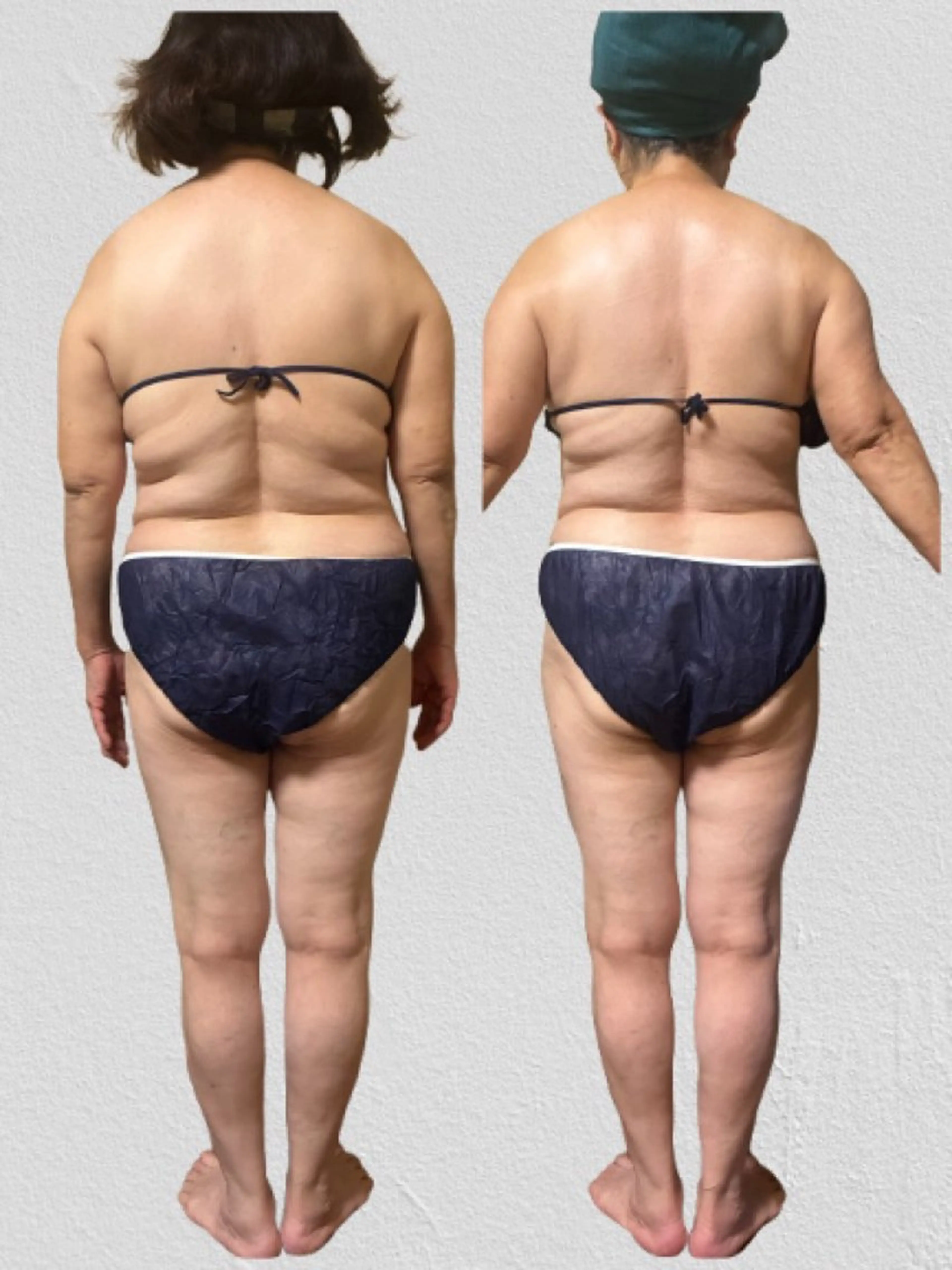 エステ デトックス×ボディメンテナンスサロンShikhara（シカラ）所属・オールハンド筋膜痩身 整体/小顔　中山朝美のエステ・リラクイメージ