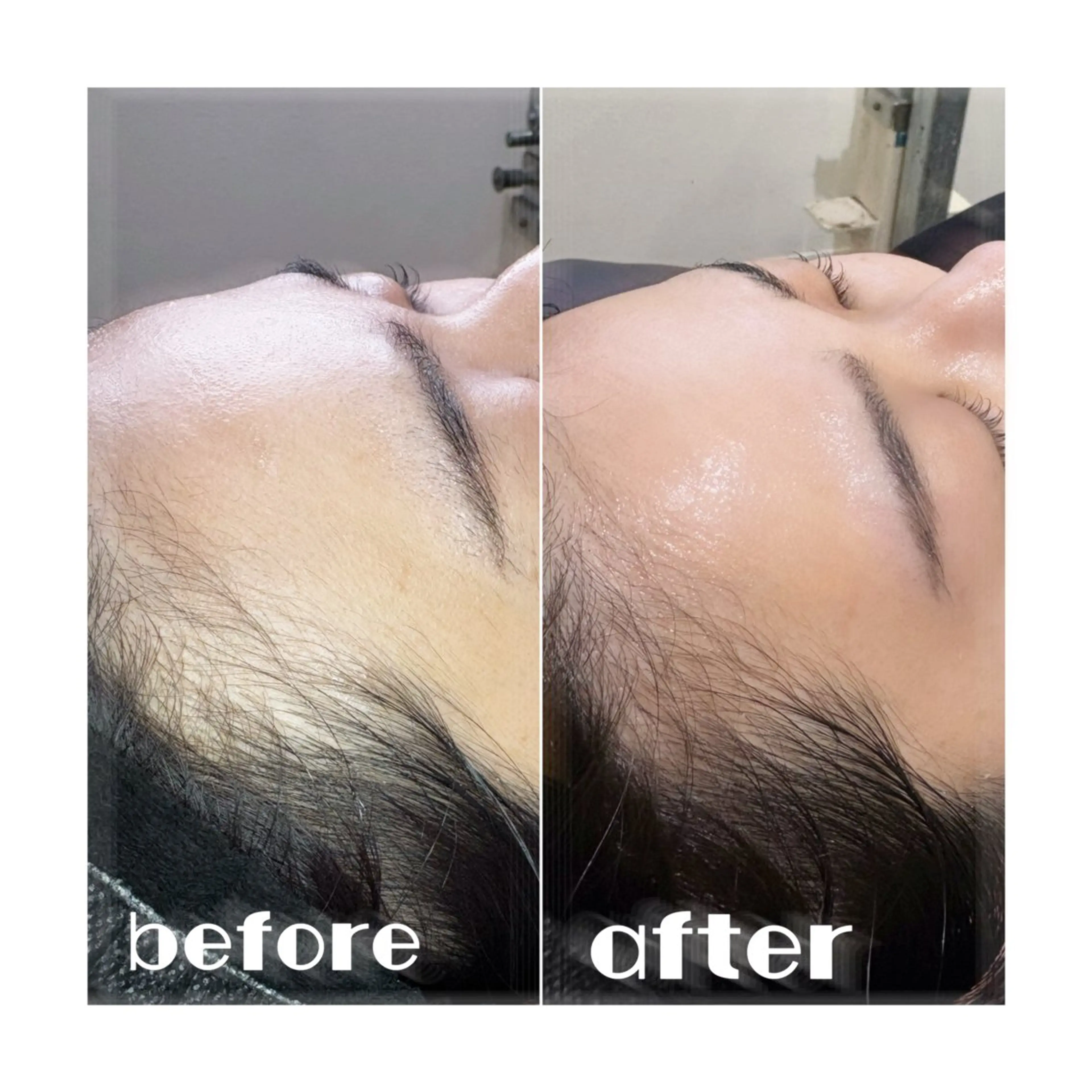 アイブロウ ハリウッドブロウリフト メンズアイブロウ 眉毛ワックス脱毛 脱毛 LAND🫧🎀 Ayakaの眉毛・アイブロウイメージ