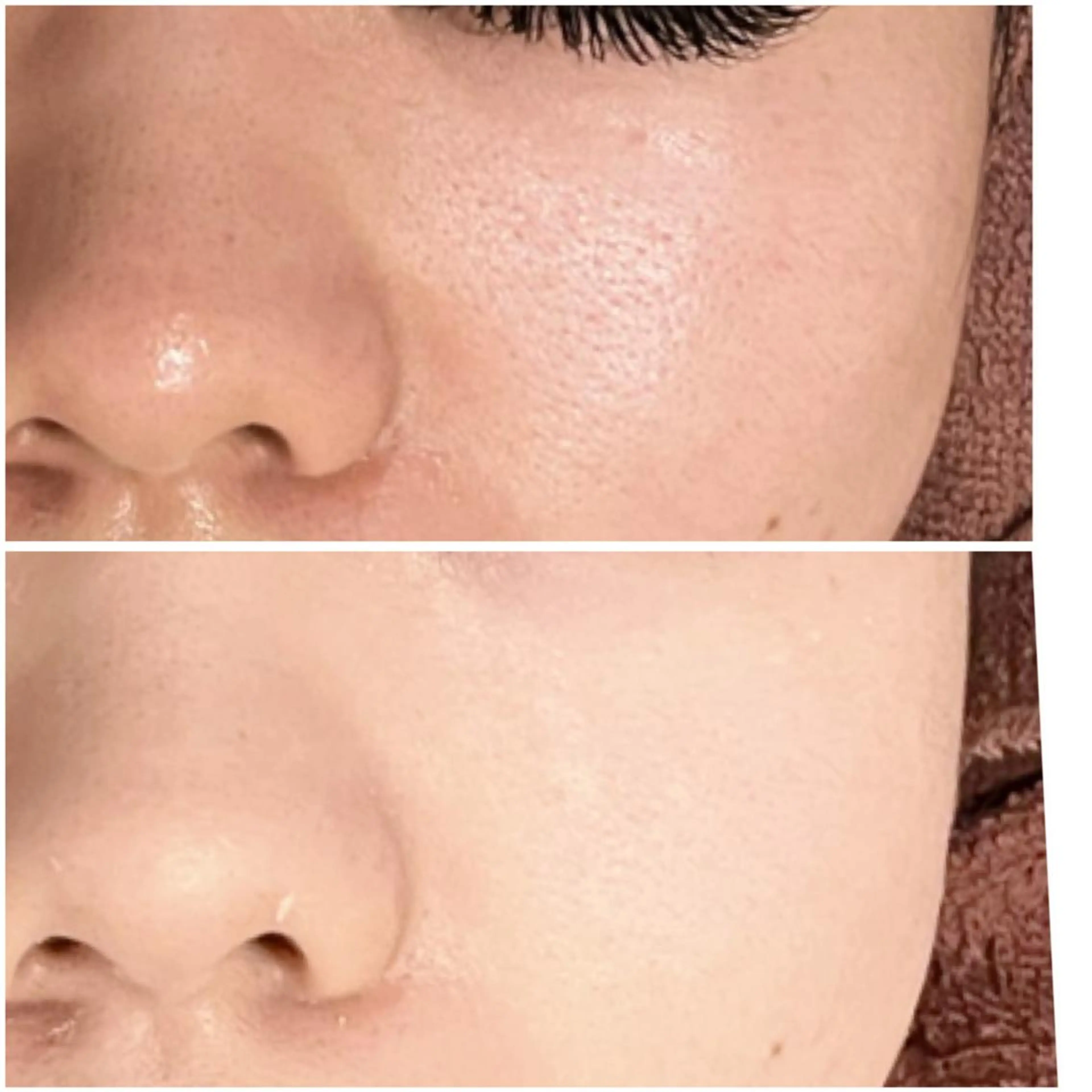 エステ リラク 🔥3か月で肌革命 🔥ニキビ専門店のエステ・リラクイメージ