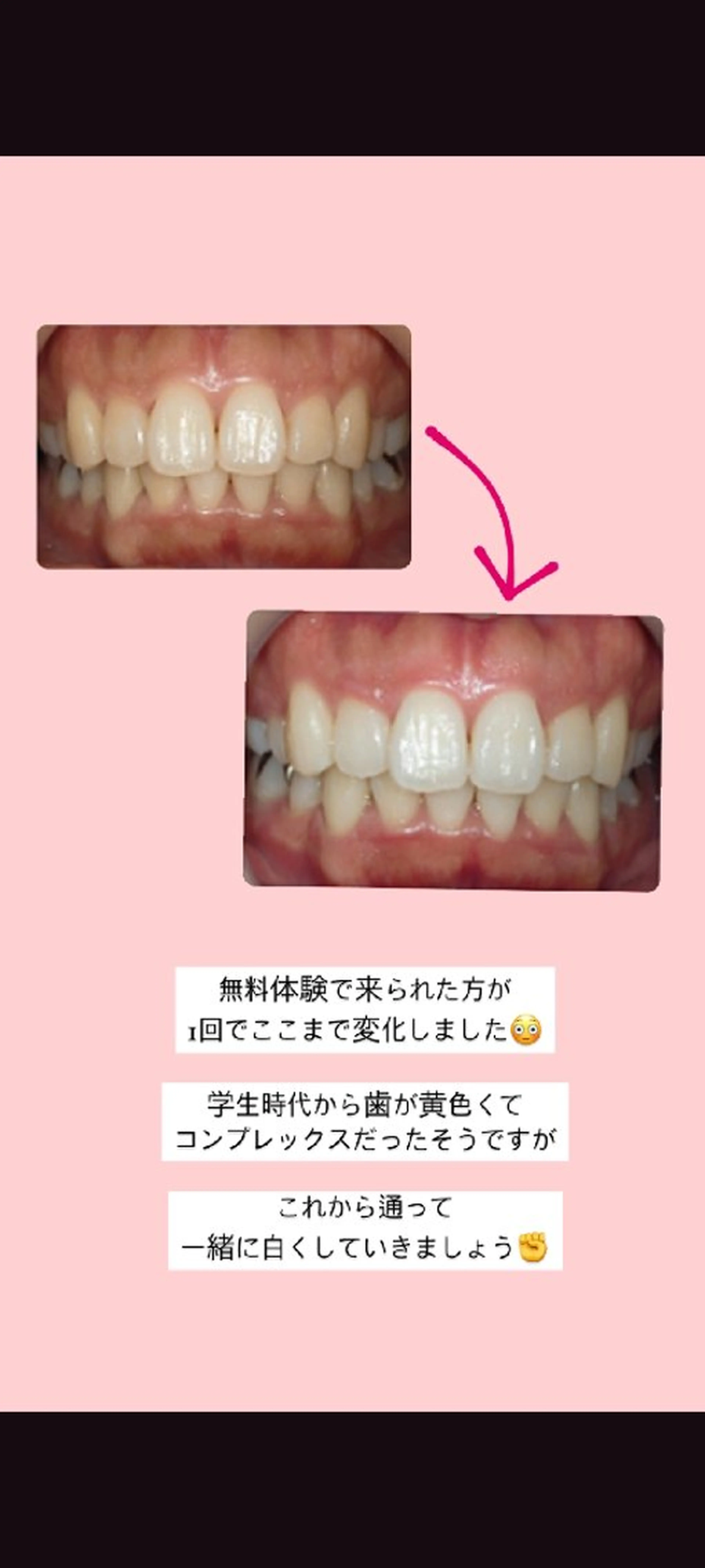 セルフホワイトニングサロン　エクシア江坂店所属・セルフホワイトニング エクシア江坂店のエステ・リラクイメージ