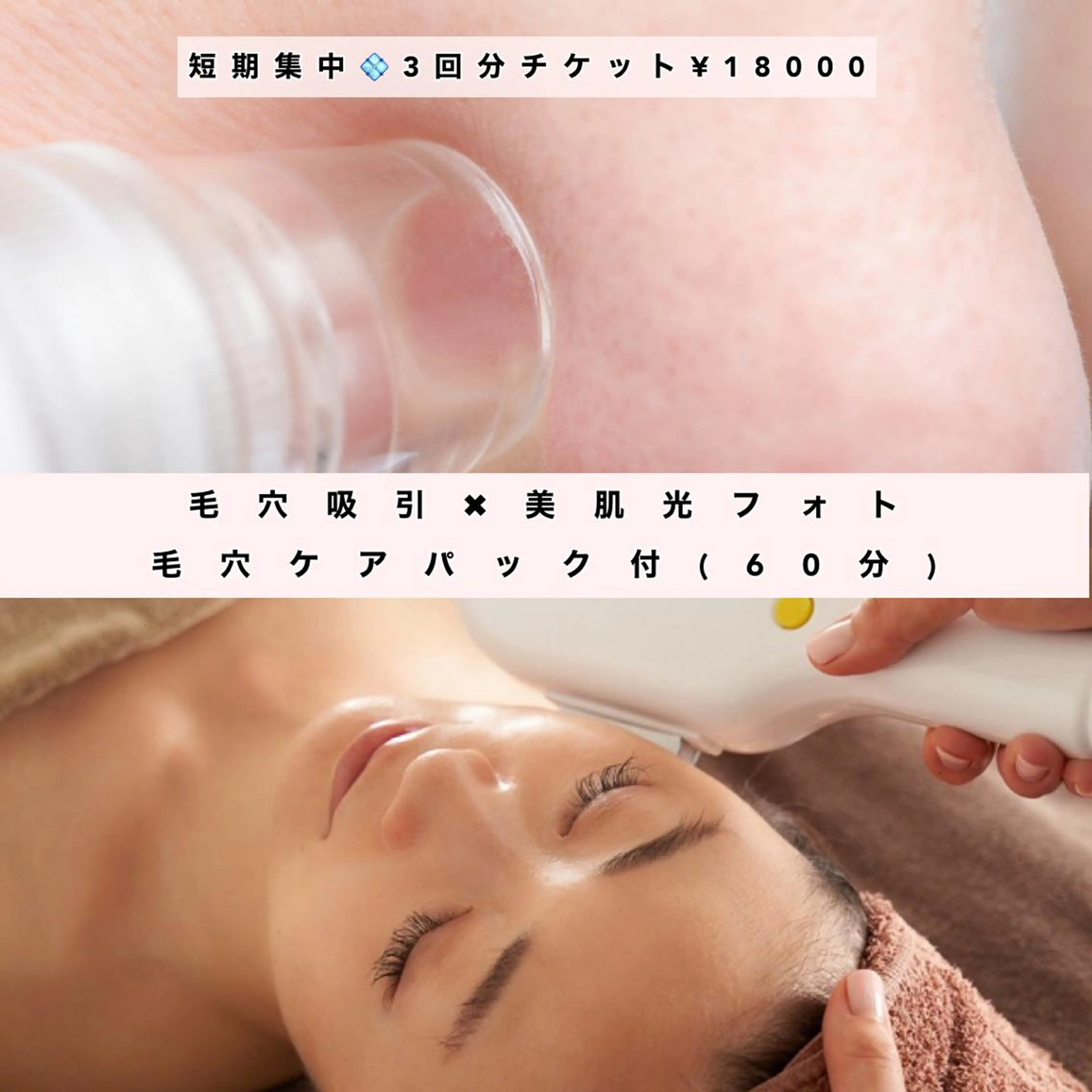 ショート カラー パーマ ヘアアレンジ メンズ キッズ ネイル マツエク・マツパ Chloe-クロエ- 脱毛/フェイシャルのエステ・リラクイメージ