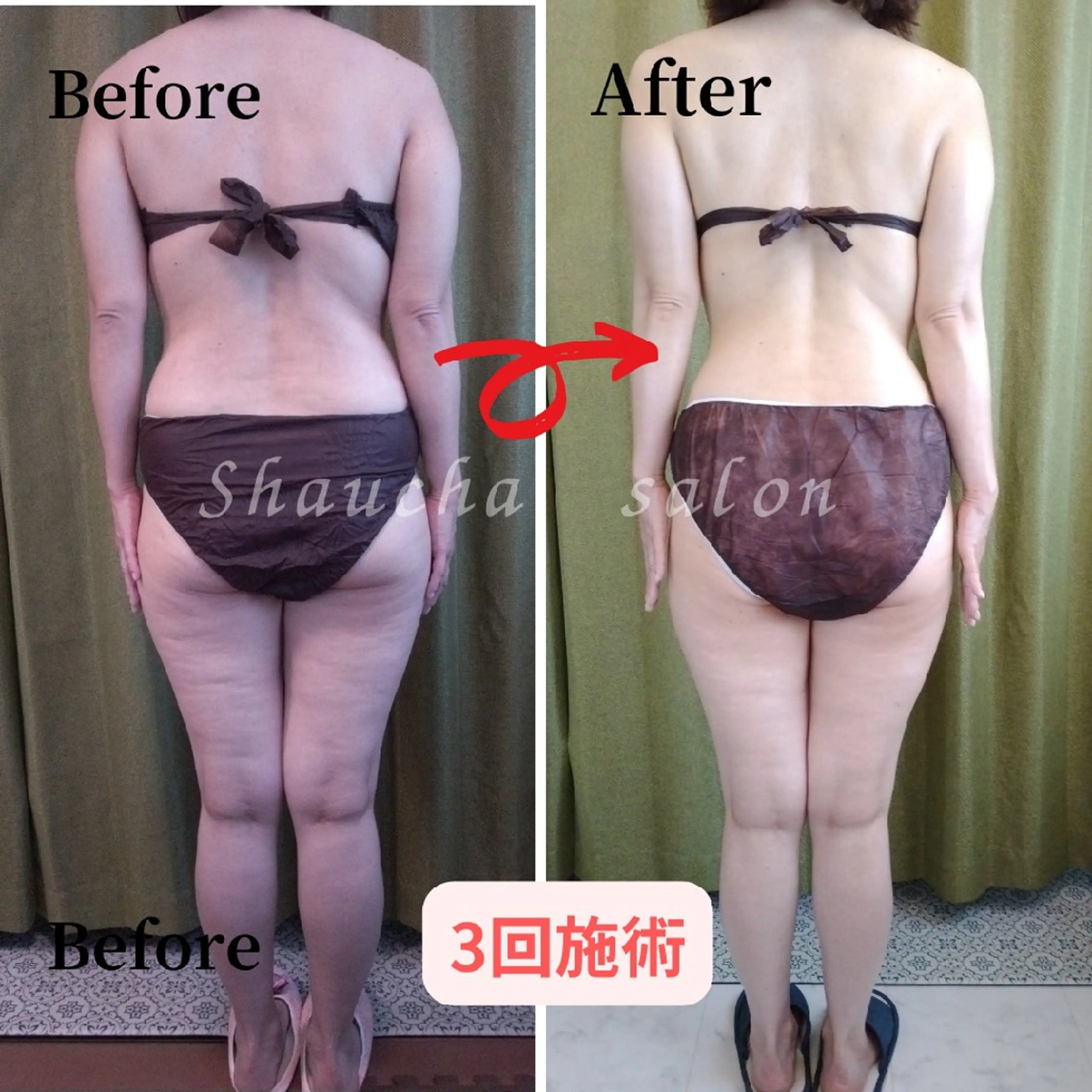 💎痩身エステサロン 💎シャウチャ奥多摩のエステ・リラクイメージ