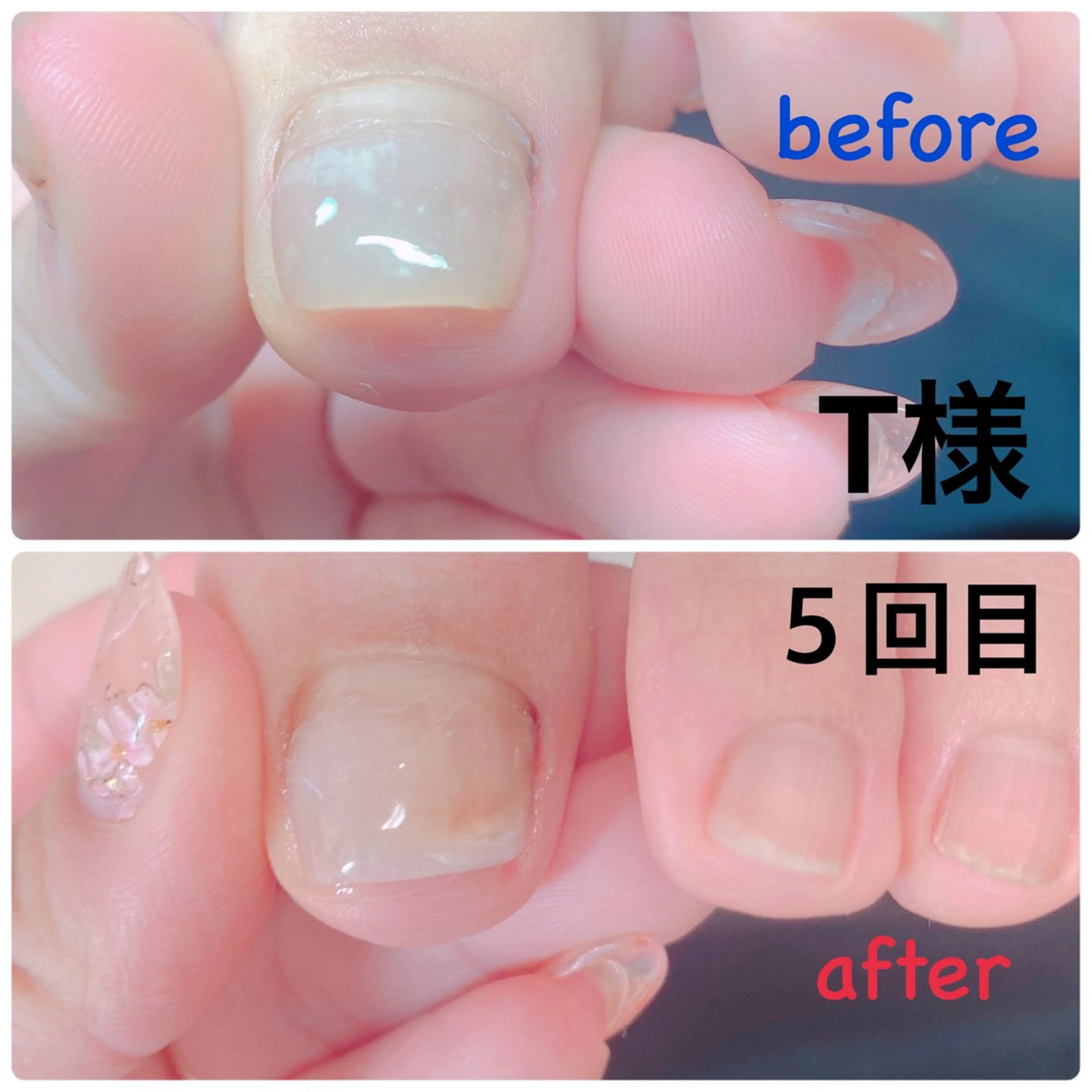 ネイル その他(ネイル) 柴崎 美幸のネイルデザイン