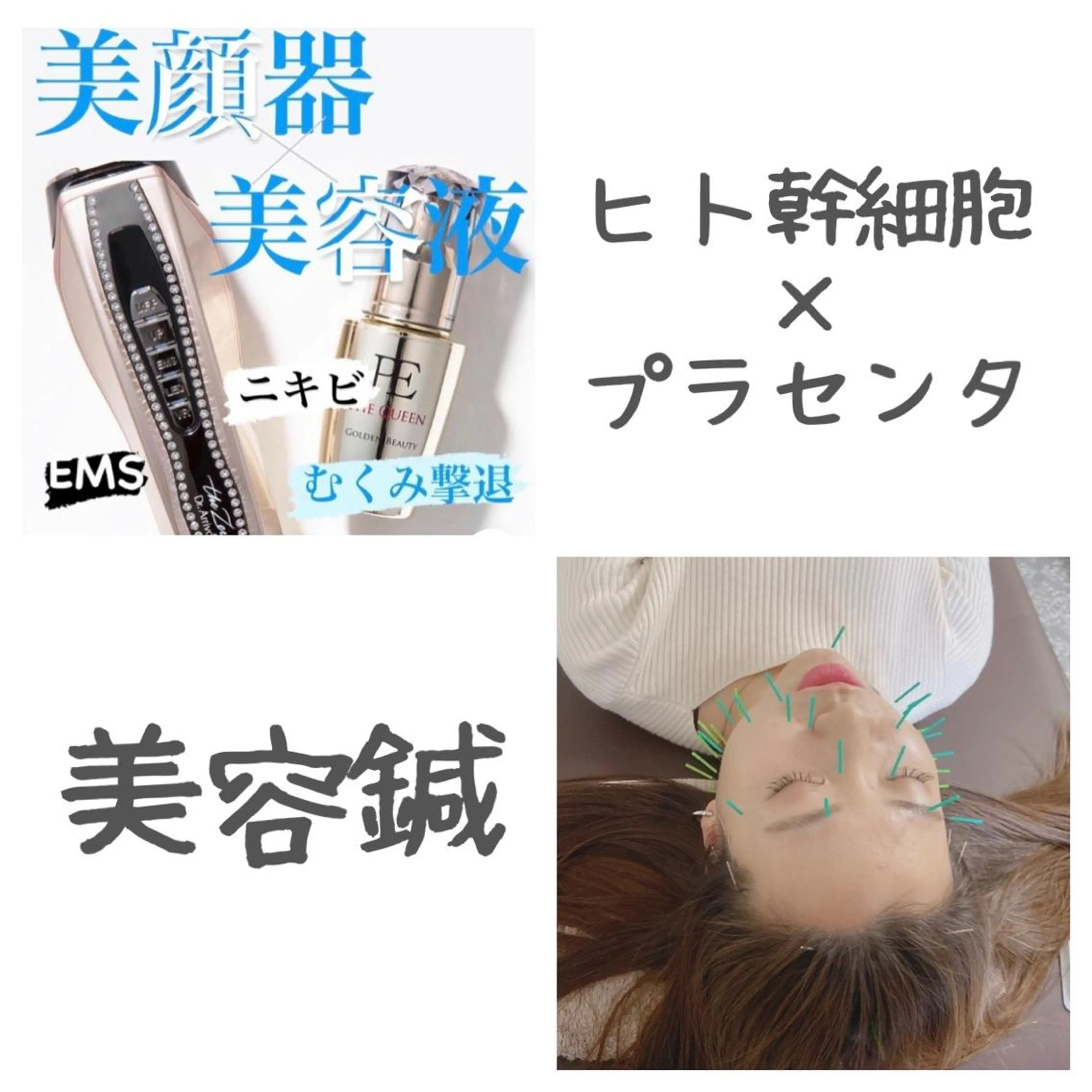 ❤️美容鍼✖︎ヒト幹細胞+プラセンタ高濃度美容液導入❤️の写真