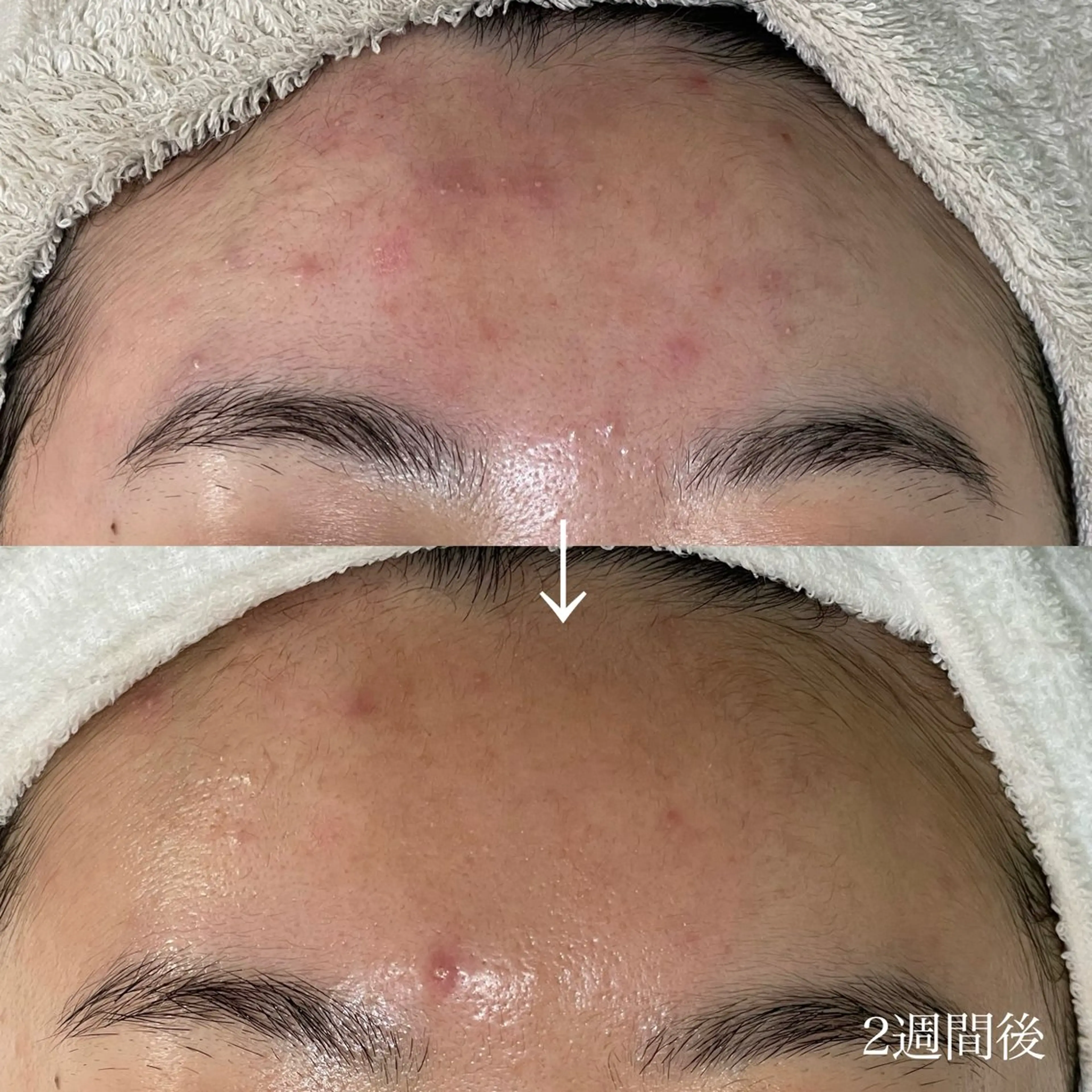 エステ シェノン所属・ニキビ・毛穴・ フェイシャル専門店のエステ・リラクイメージ