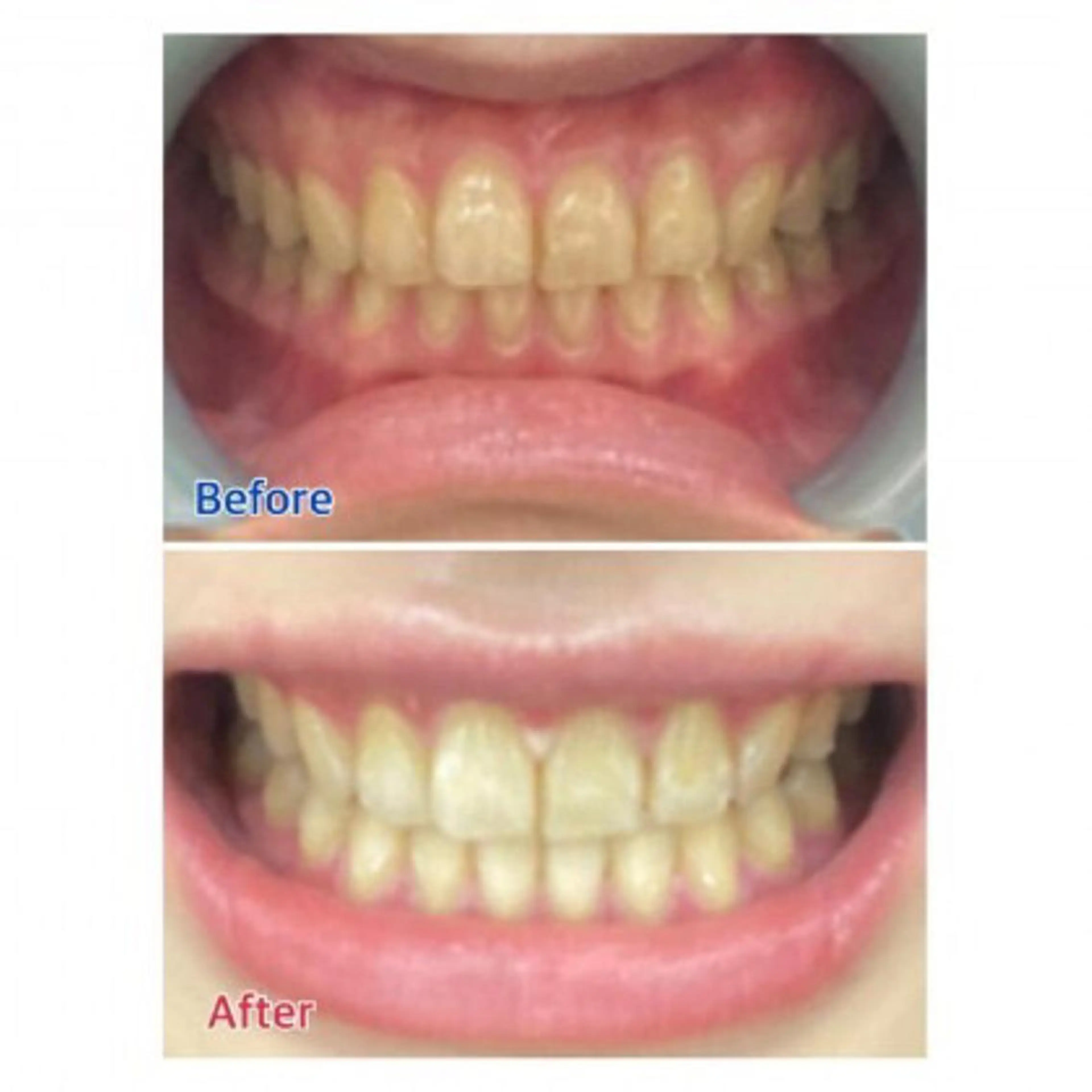 M渋谷店所属・Ｍ渋谷 ホワイトニングのエステ・リラクイメージ