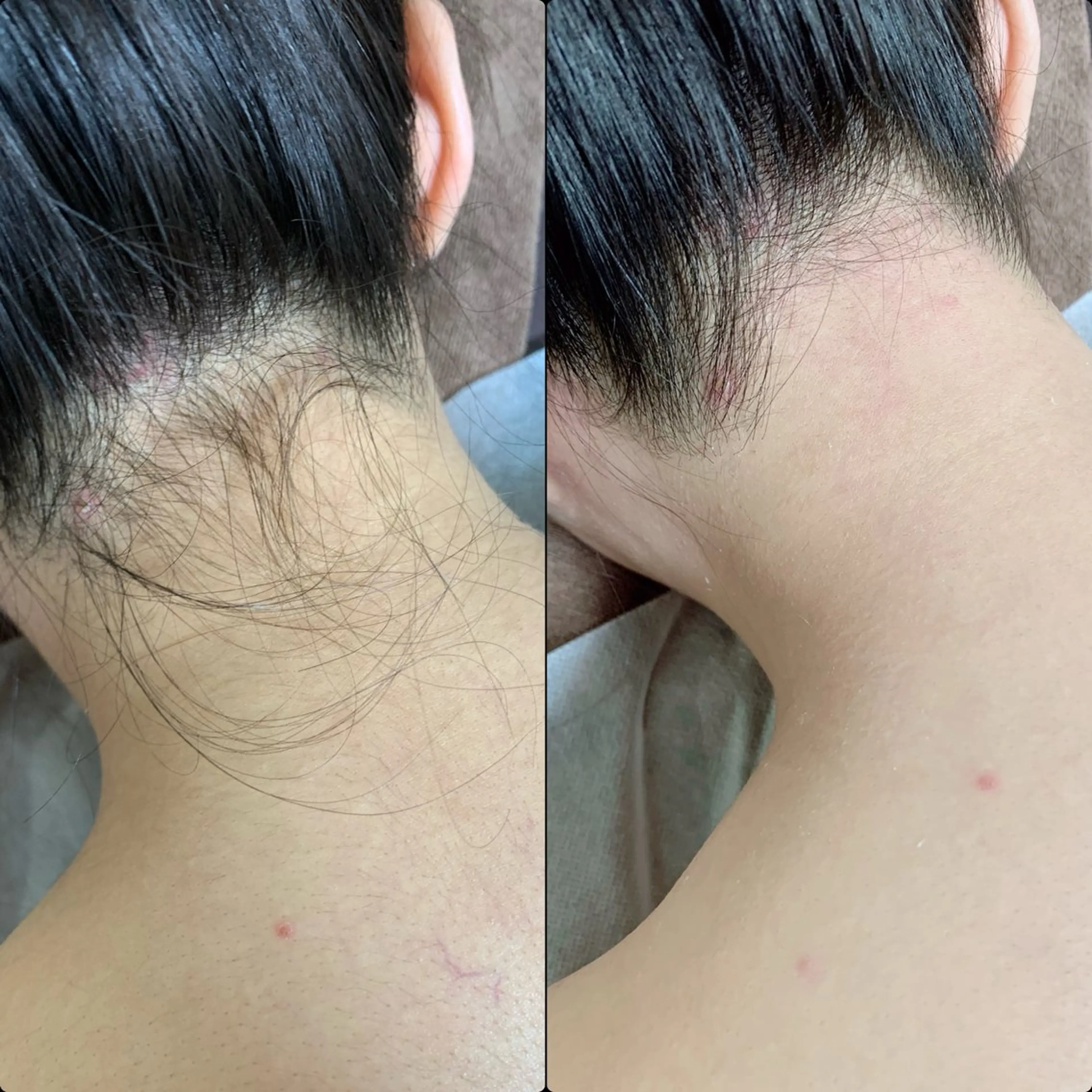 六本木脱毛andS 店長Sachiのエステ・リラクイメージ