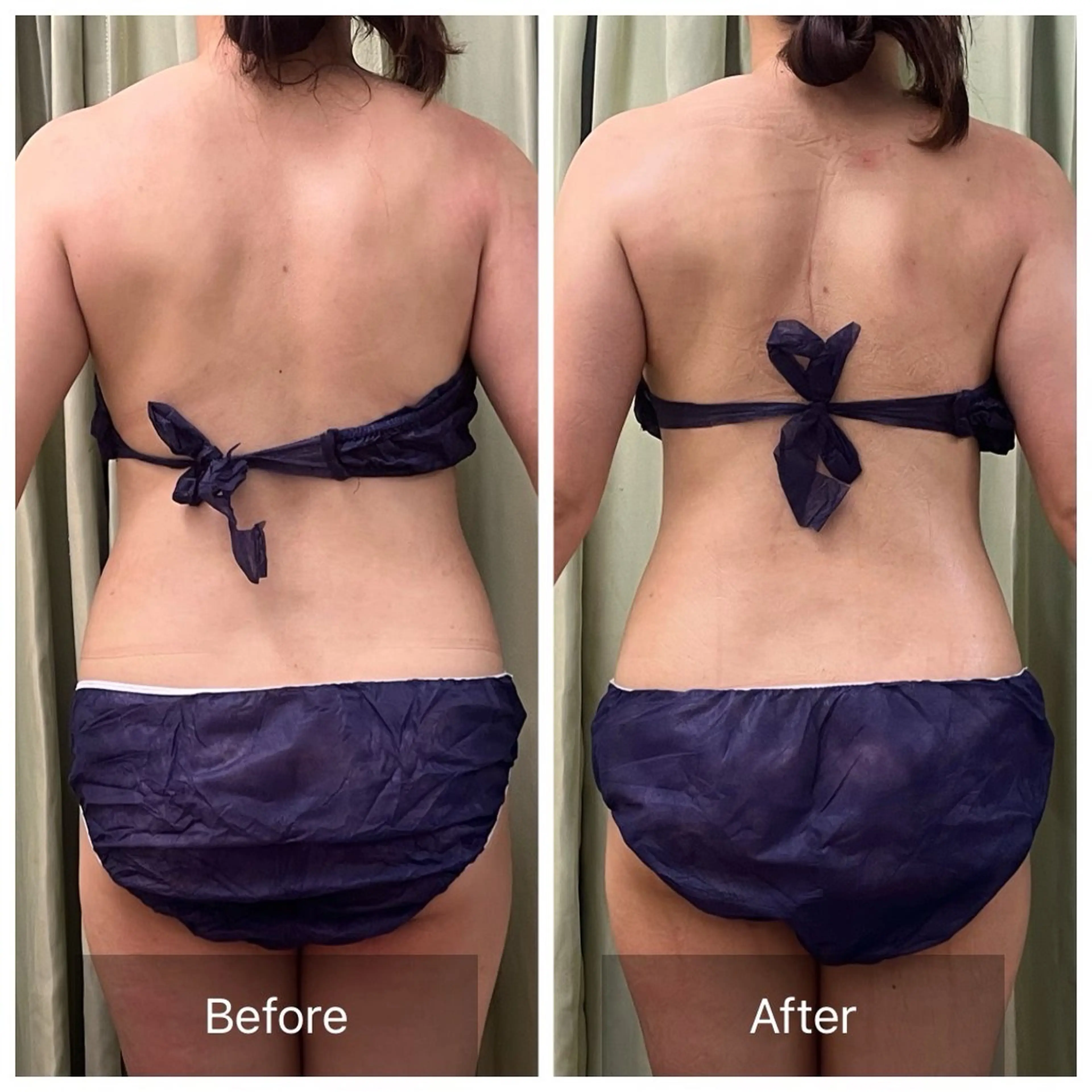 【人気No.1】筋膜×腸もみ🌱首肩こり/腰痛/便秘/くびれ/足のむくみに🌟 全身90分の写真