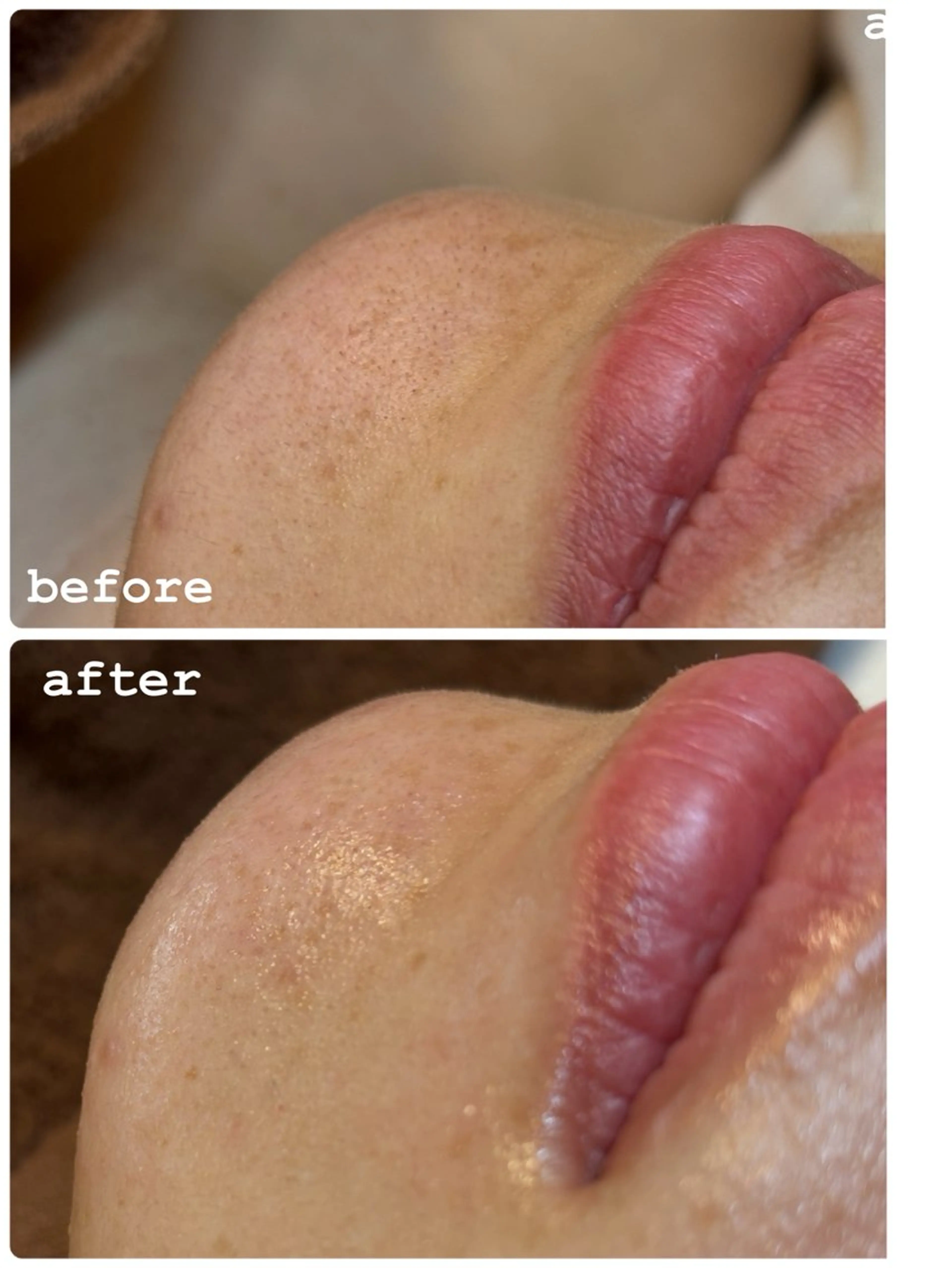 その他 sourire.11 ‪☺︎‬‪emiのエステ・リラクイメージ