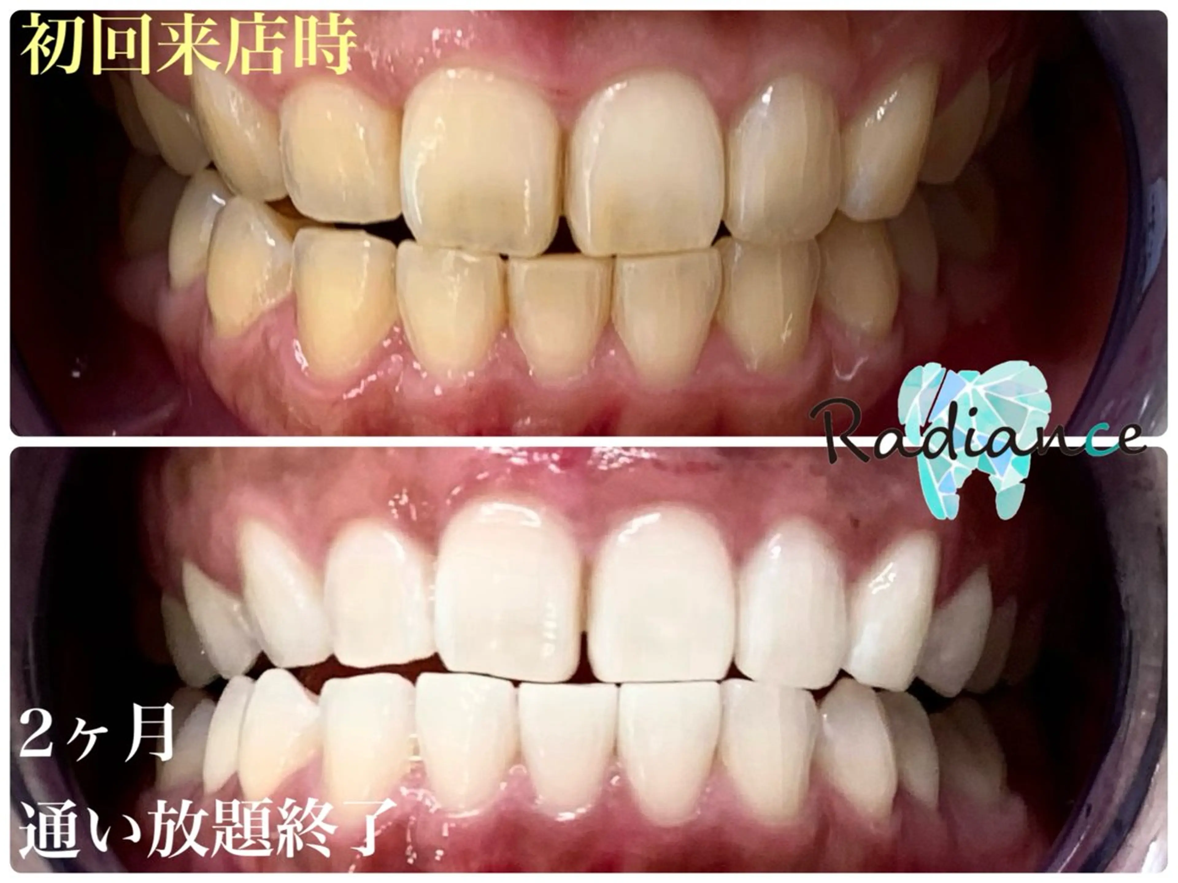 札幌ホワイトニング ラディアンス札幌駅店のその他イメージ