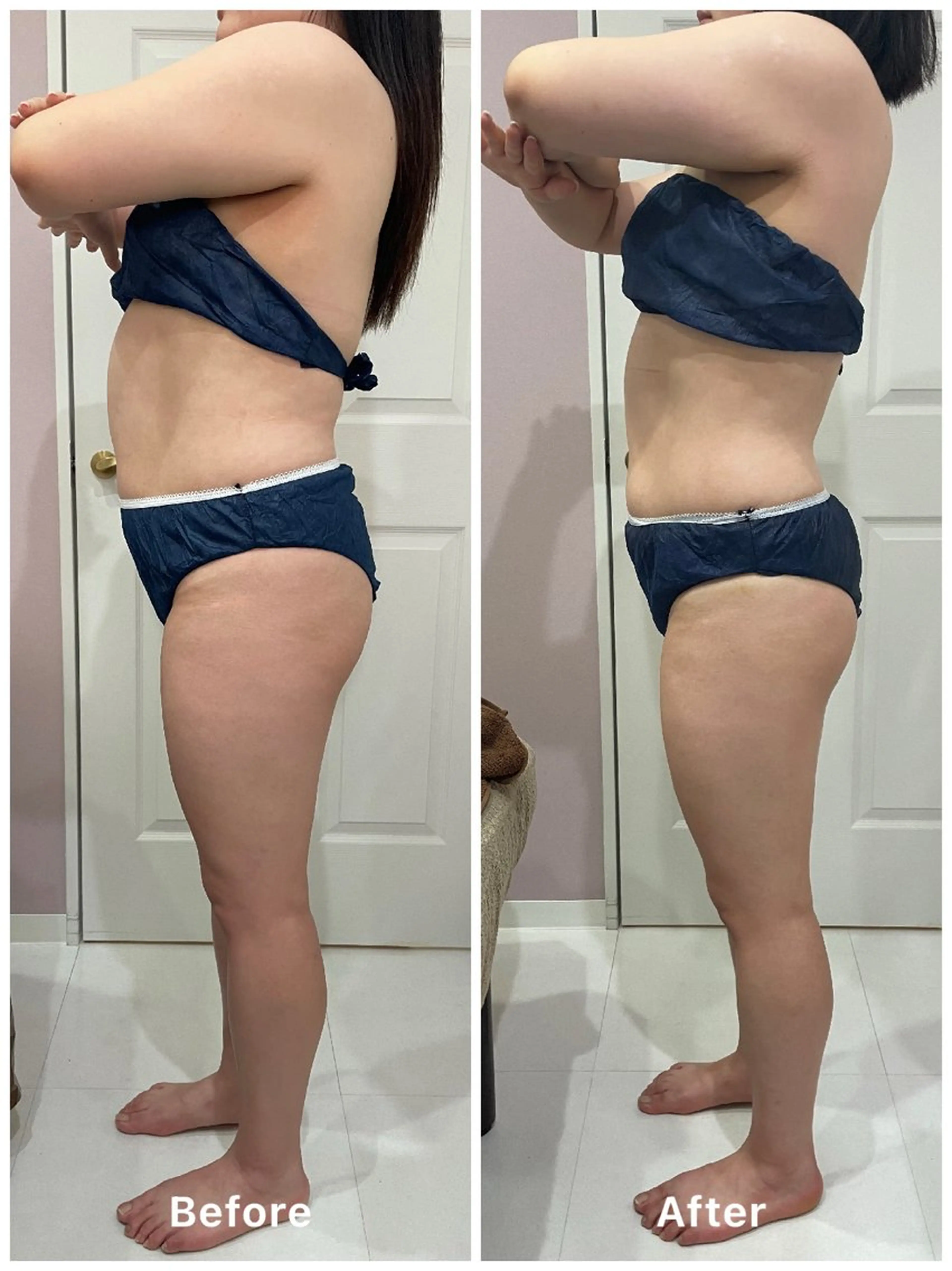 【痩身初回体験】上半身or下半身￥5000の写真