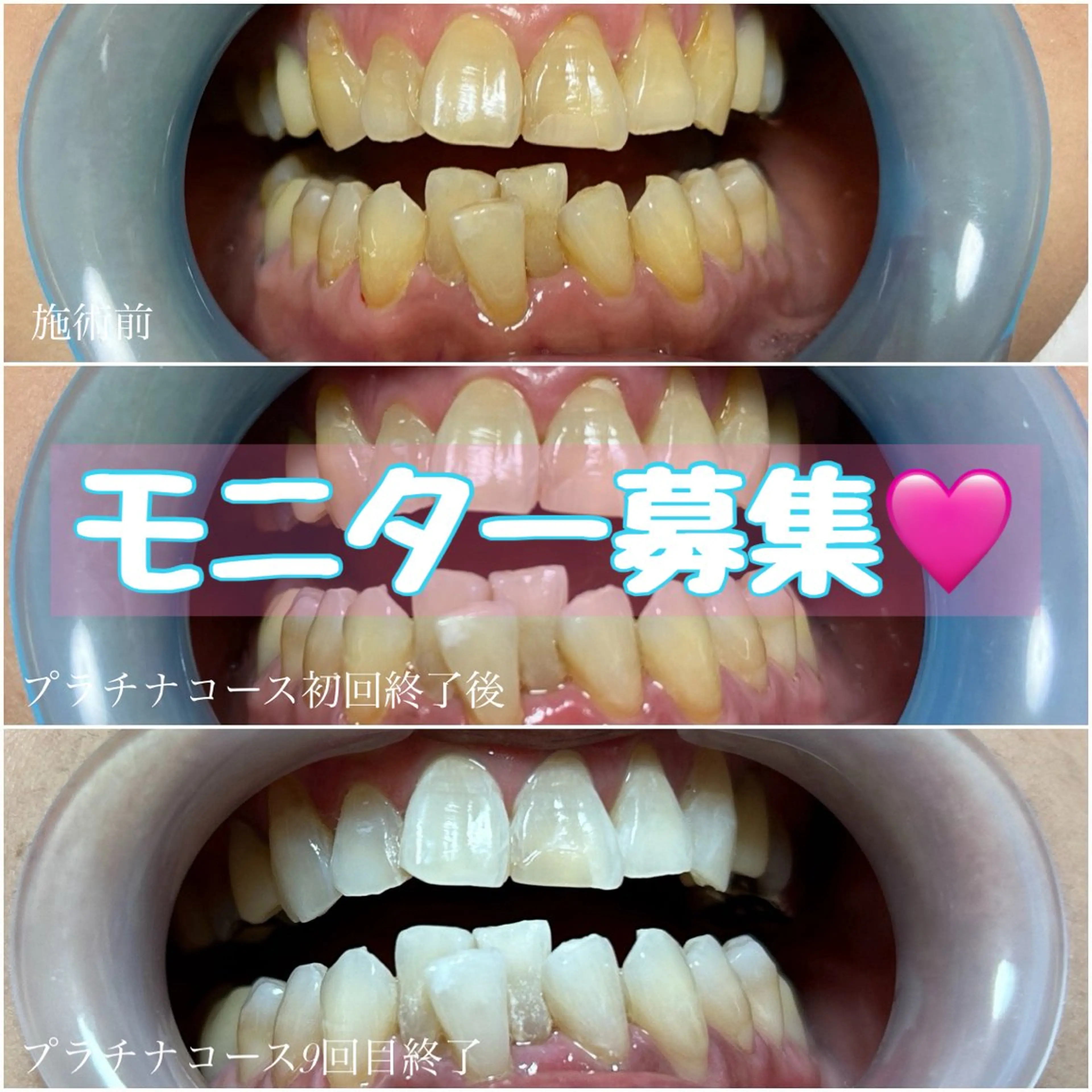 無料カウンセリング🦷🪥の写真