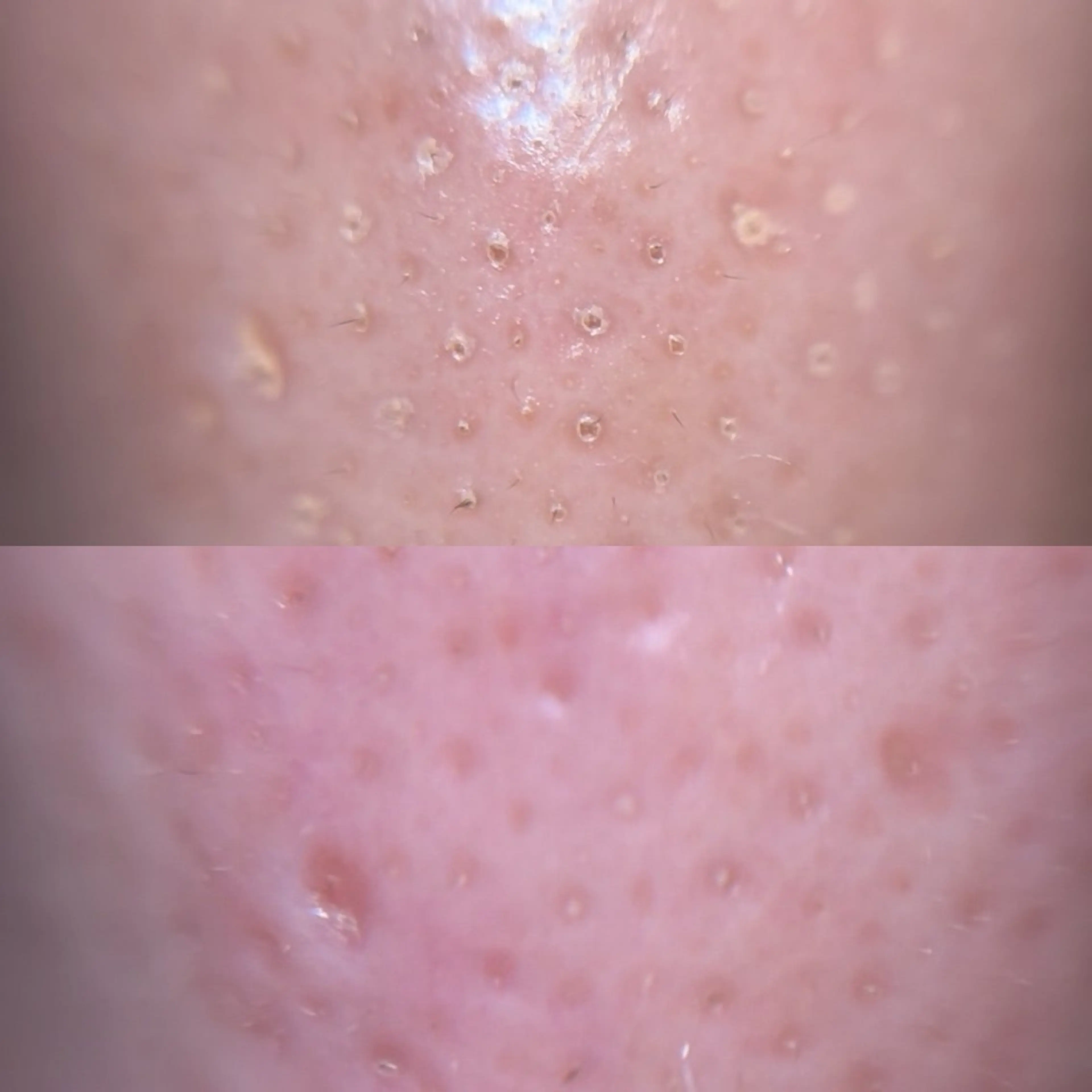 エステ 毛穴ケア/毛穴診断/ 毛穴洗浄〔心斎橋〕のエステ・リラクイメージ