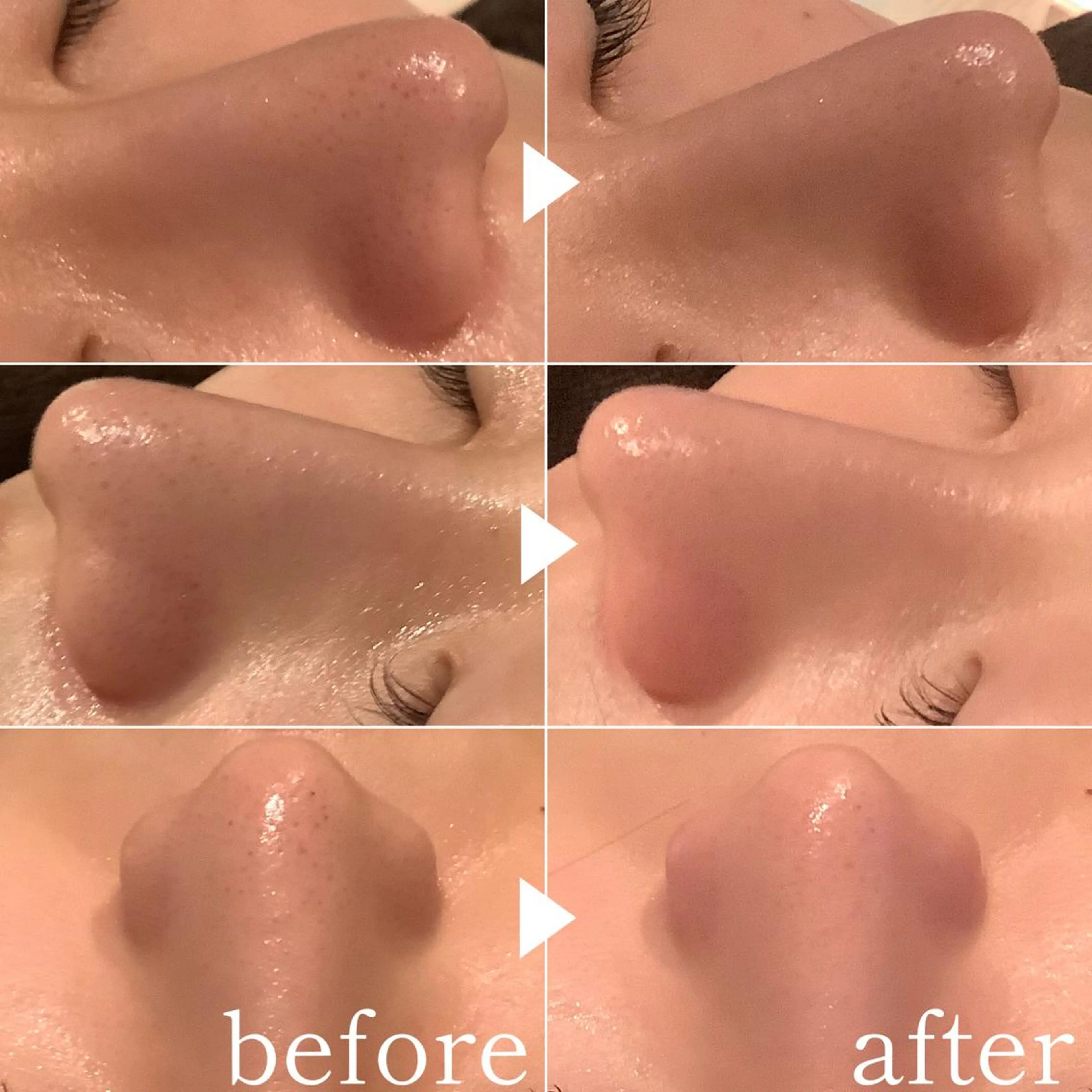 エステ 脱毛&エステサロン JIGGLY武蔵小山のエステ・リラクイメージ