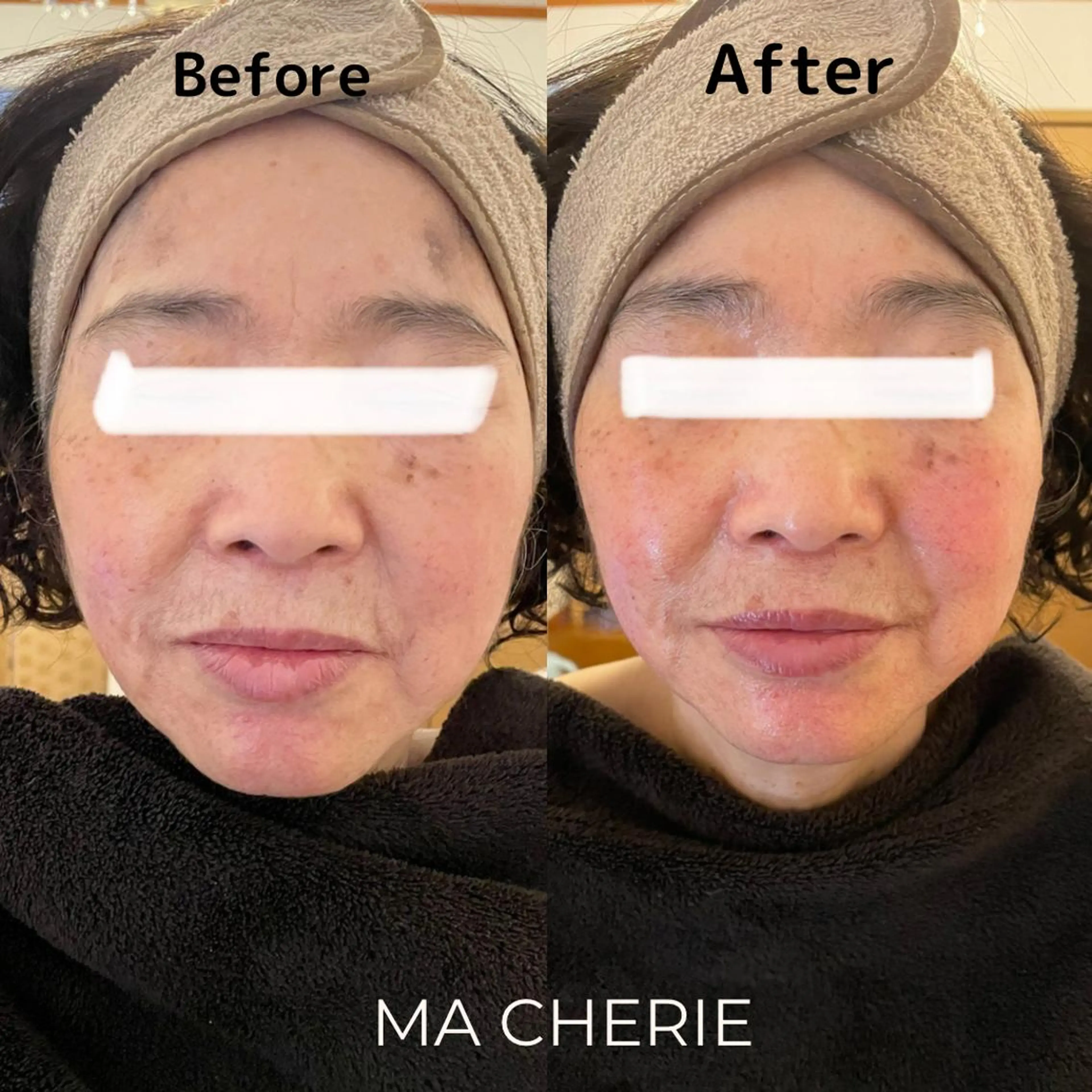 MA CHÉRIE所属・体質別痩身&小顔 MA CHÉRIEのエステ・リラクイメージ