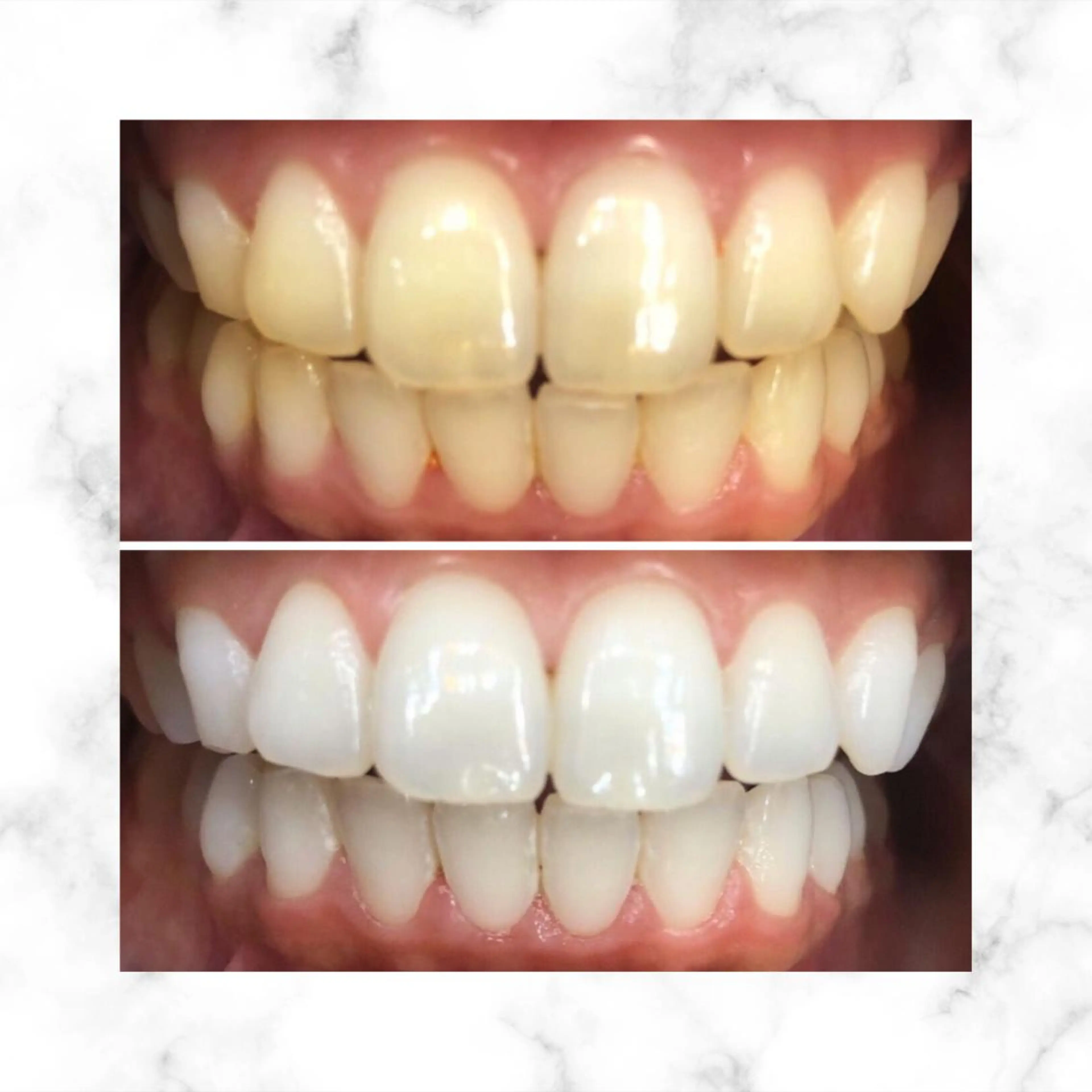 LBSホワイトニング 🌐渋谷店スタッフのエステ・リラクイメージ