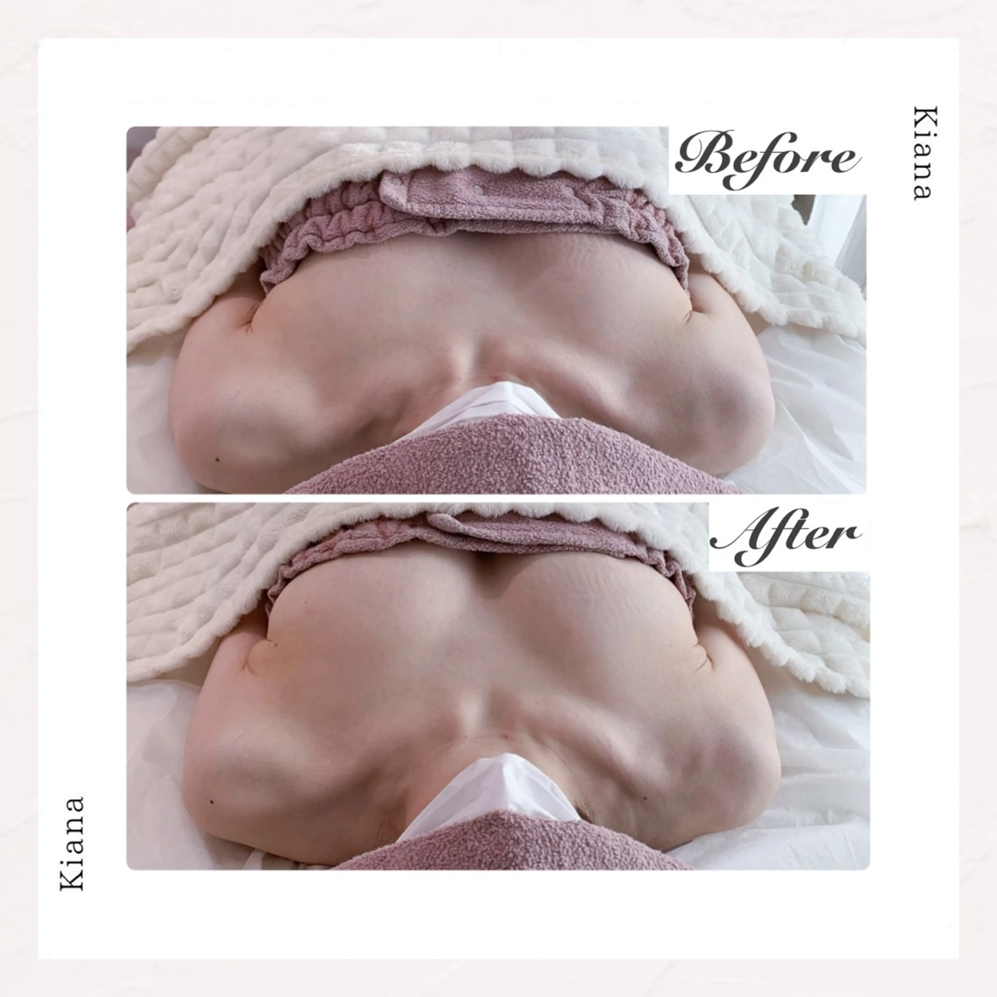 バスト専門Kiana 風のエステ・リラクイメージ