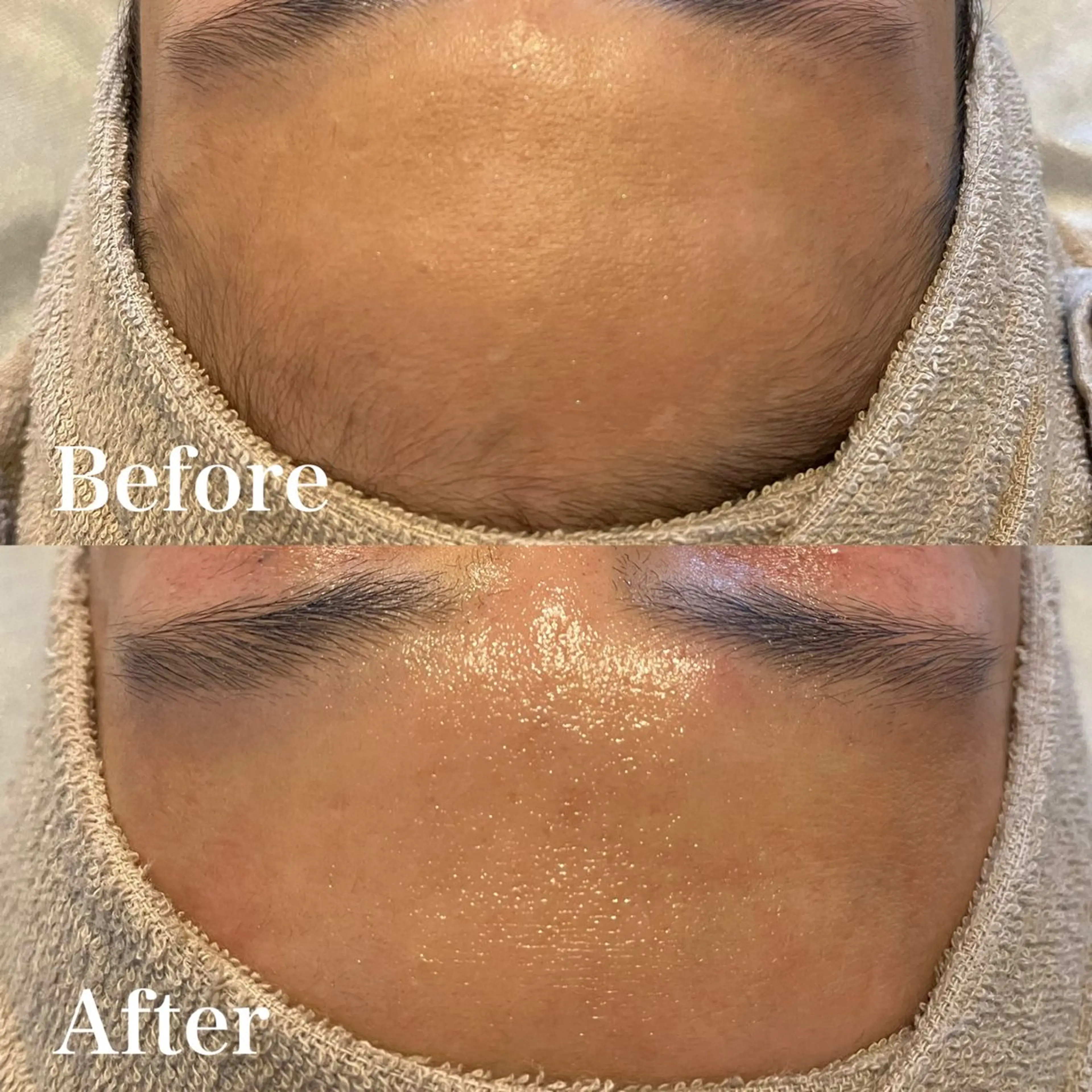 脱毛 wax脱毛専門店 ハイラントのエステ・リラクイメージ