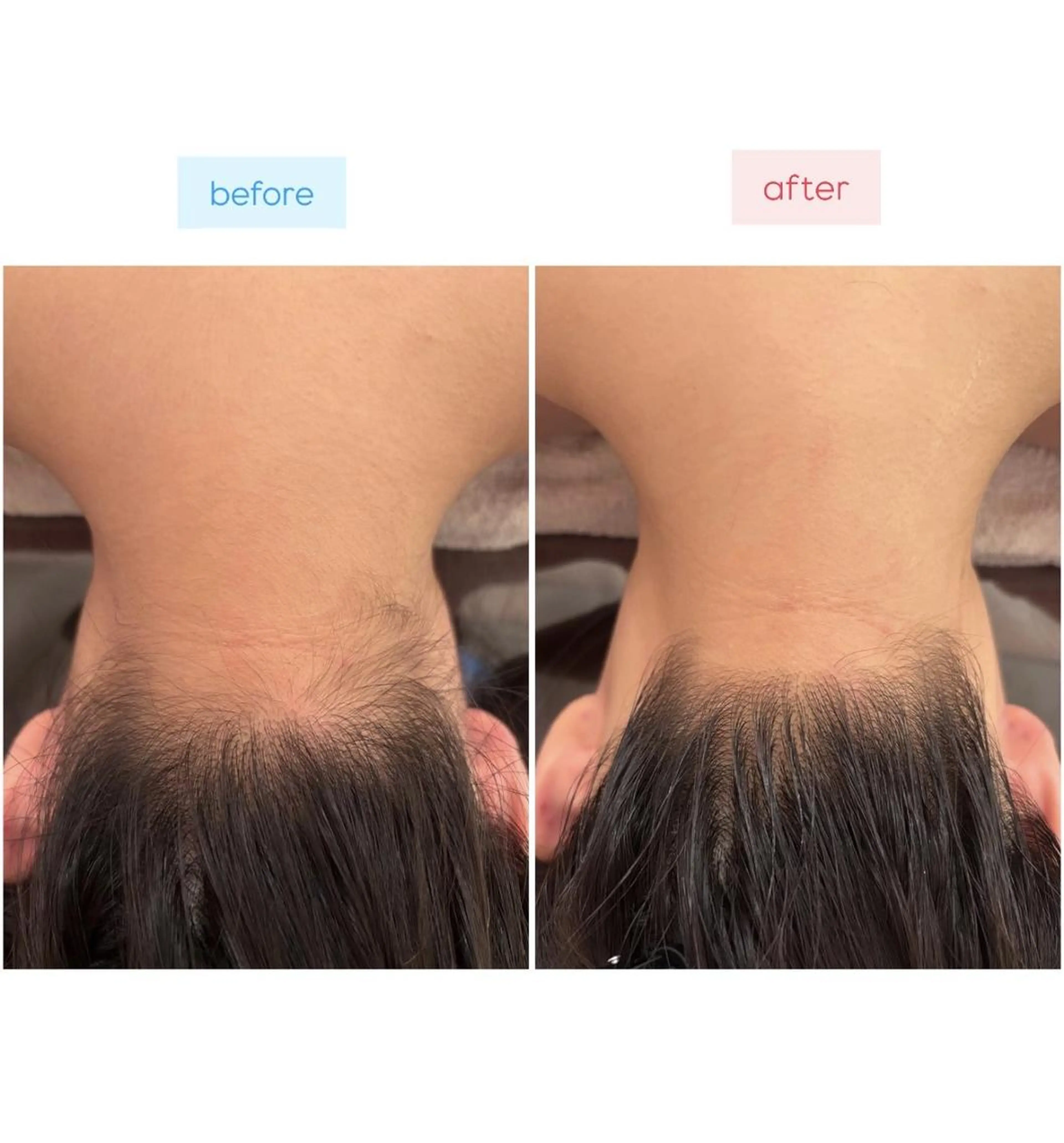 脱毛 鈴木 愛花のエステ・リラクイメージ