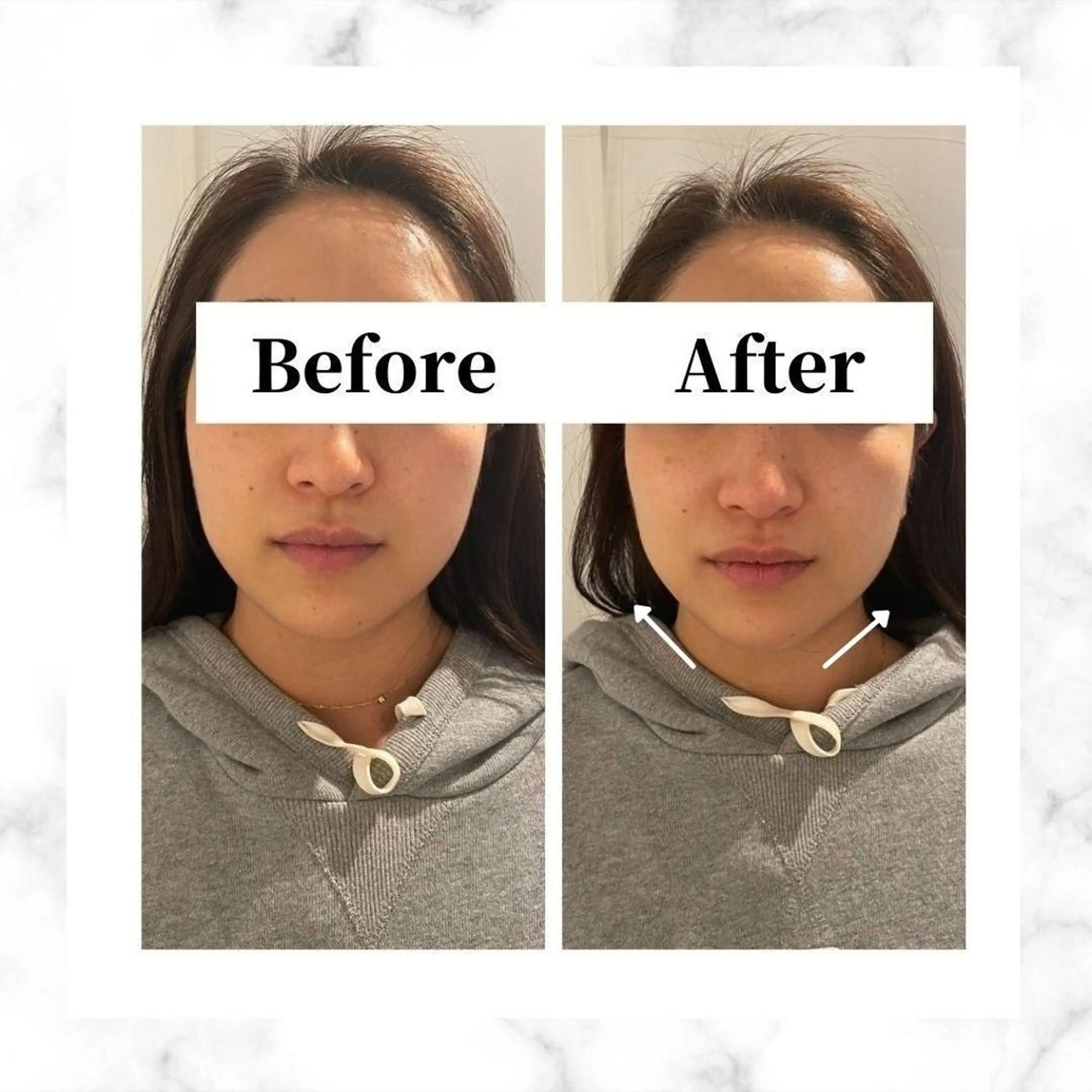 エステ リラク 12Dハイフ💗 最強小顔のエステ・リラクイメージ