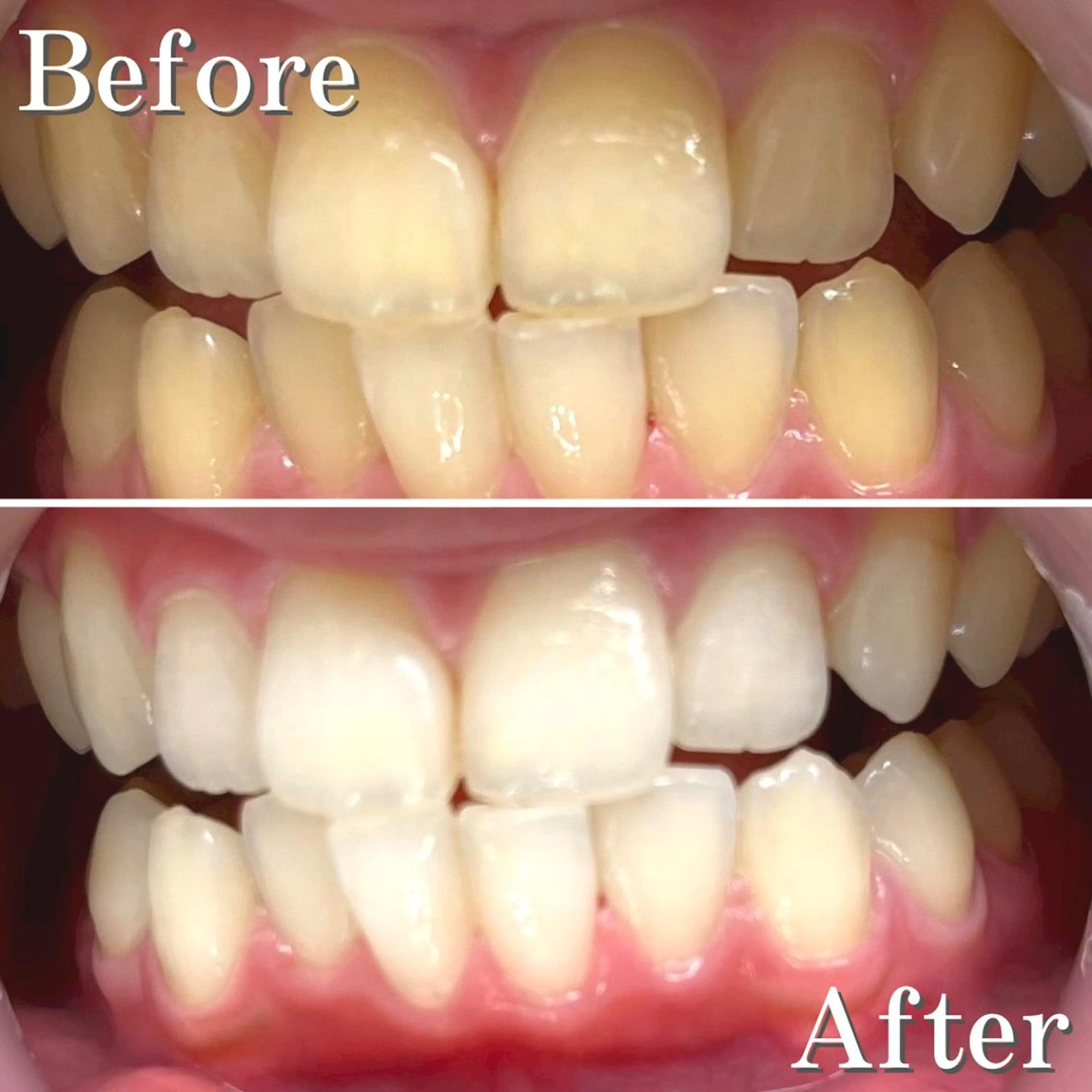 ショート パーマ カラー ヘアアレンジ メンズ ネイル マツエク・マツパ アイブロウ 結婚式・ブライダル メンズアイブロウ 結婚式・ブライダル メンズネイル ブライダルネイル LBSホワイトニング 銀座店💎店長浦和のその他イメージ