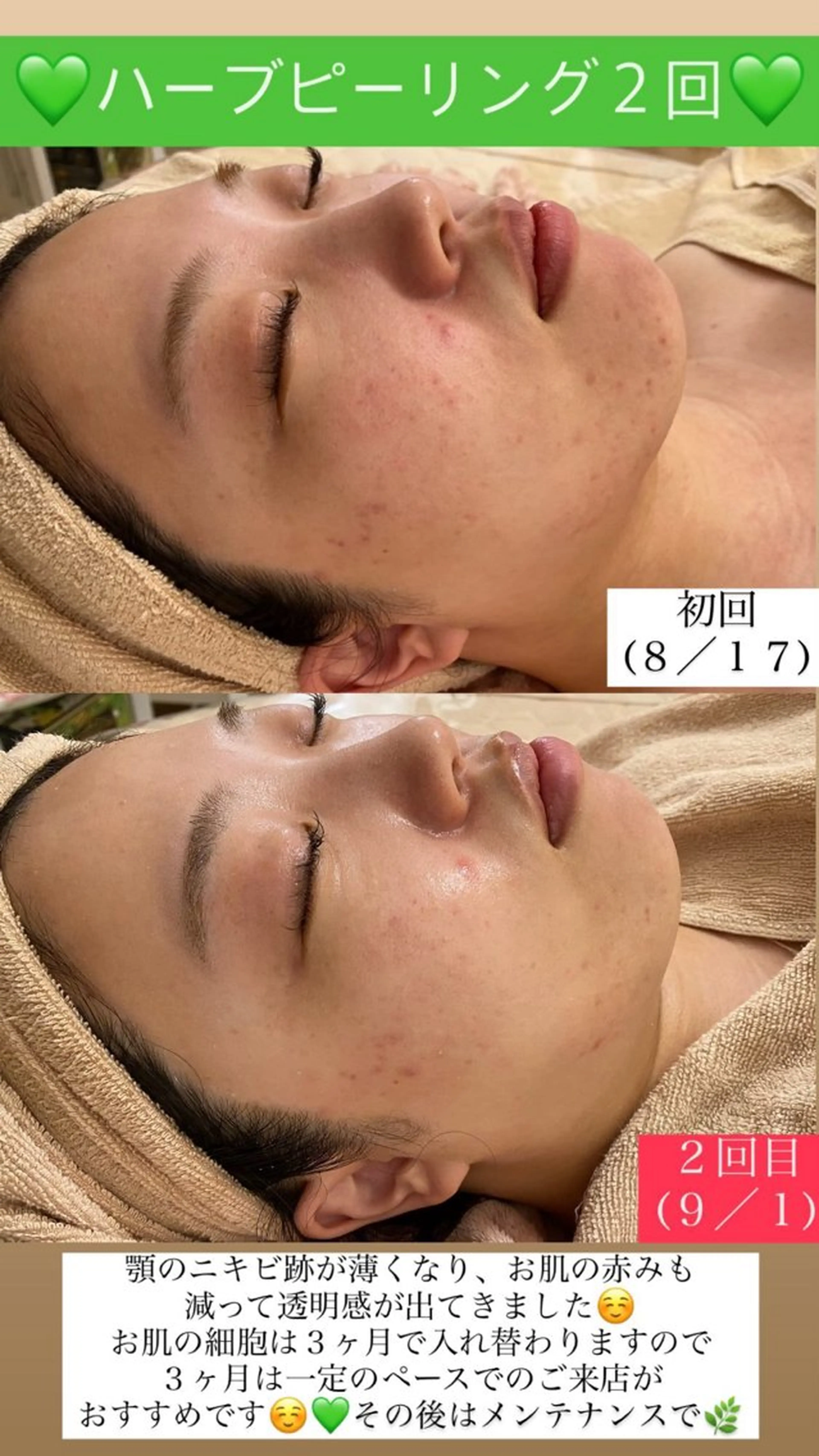 メンズ エステ Salon de Lino 御器所のエステ・リラクイメージ