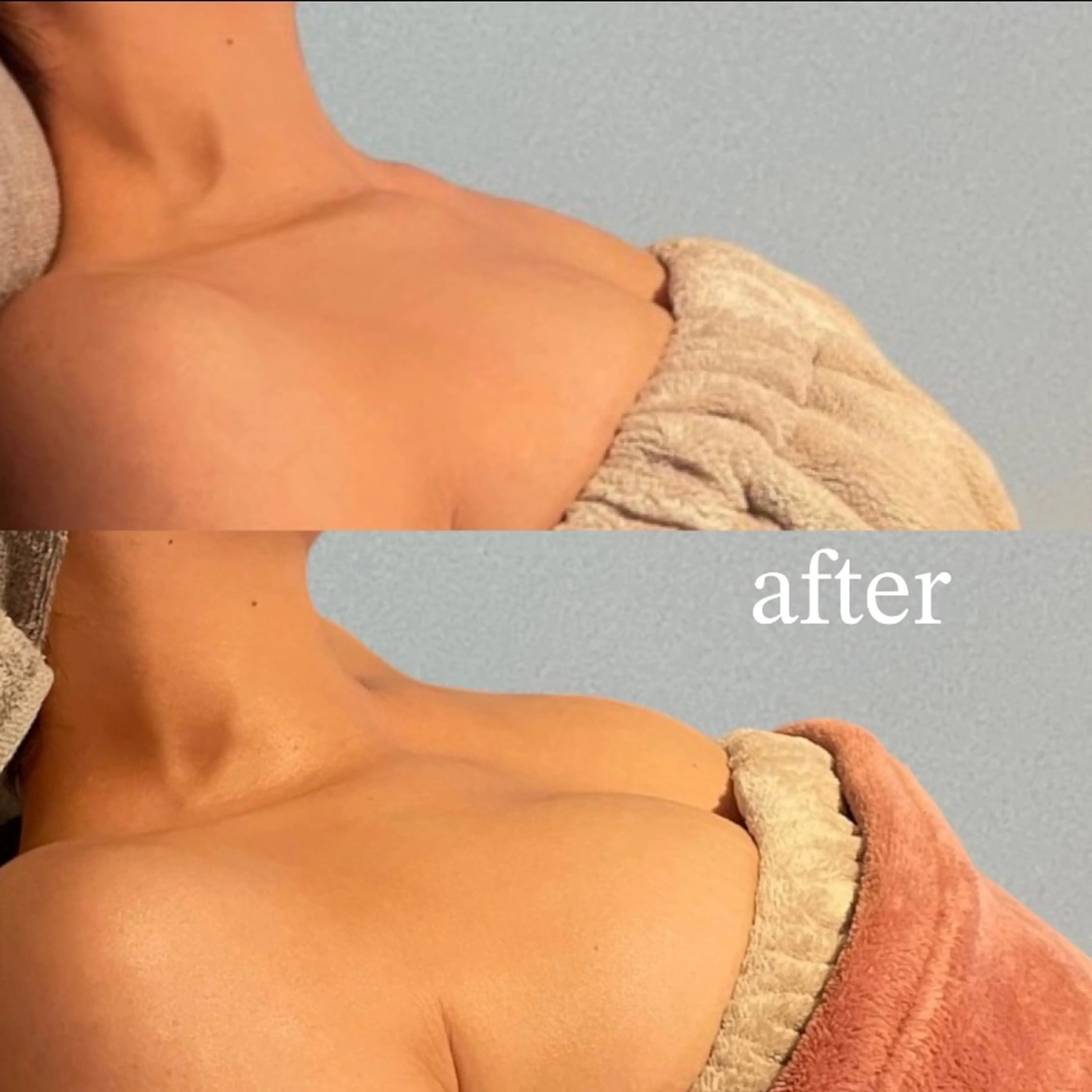 【学割U24】50%OFF☆ 別人級バストアップ 75分 ¥22000→¥11000の写真