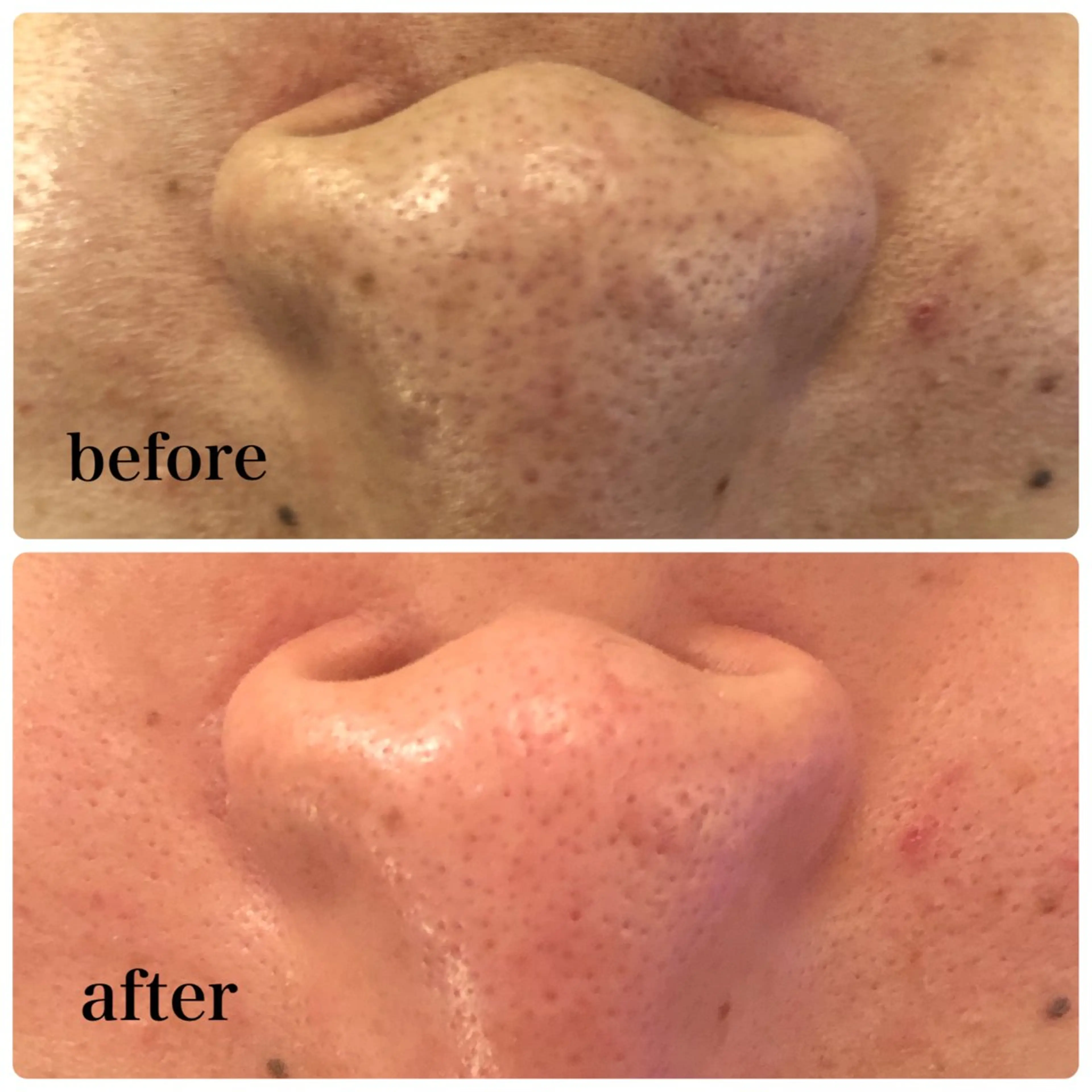 Salon de cheri サロンドシェリ人形町店所属・毛穴のお悩み・シミ 松本瞳のエステ・リラクイメージ