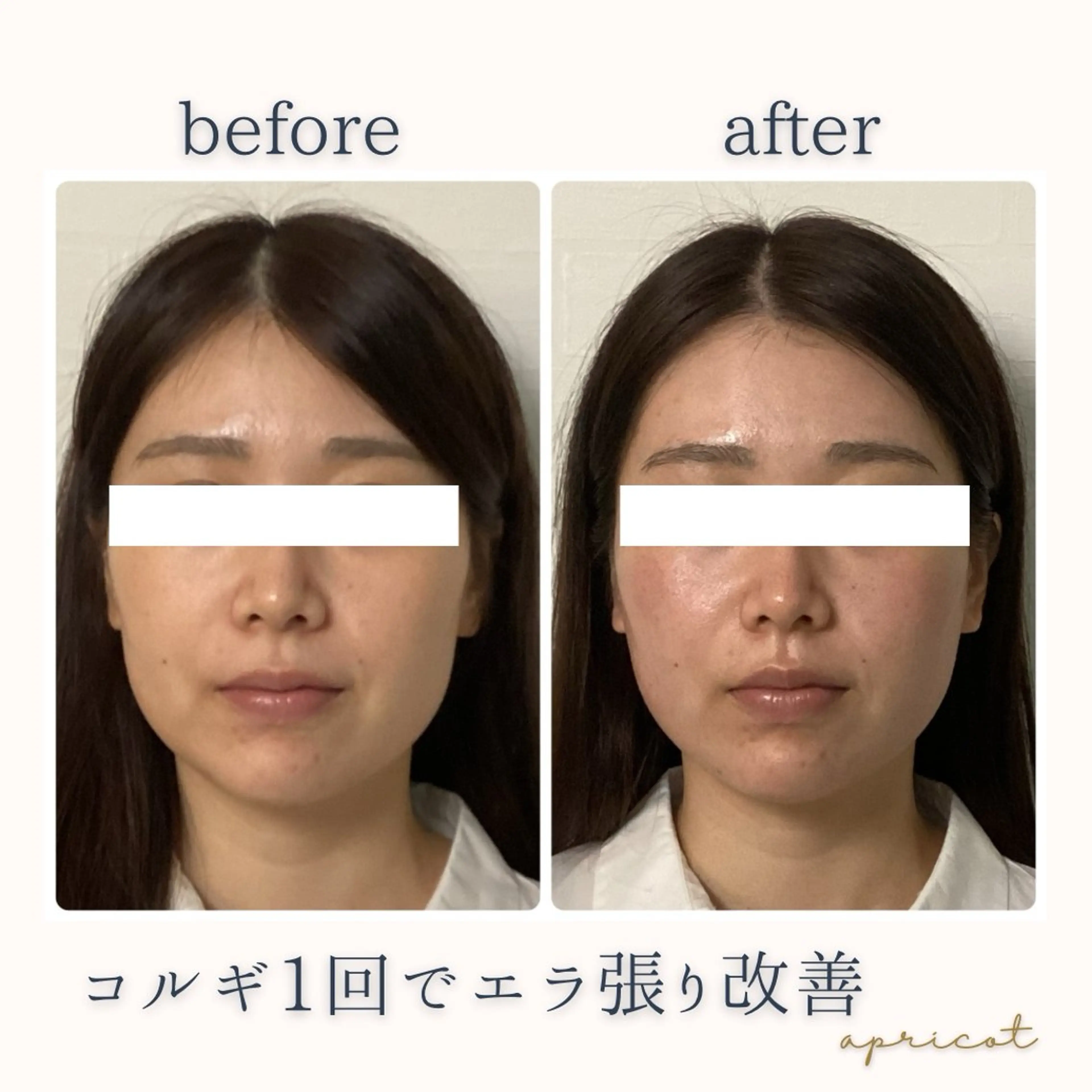 エステ リラク apricot Asukaのその他イメージ