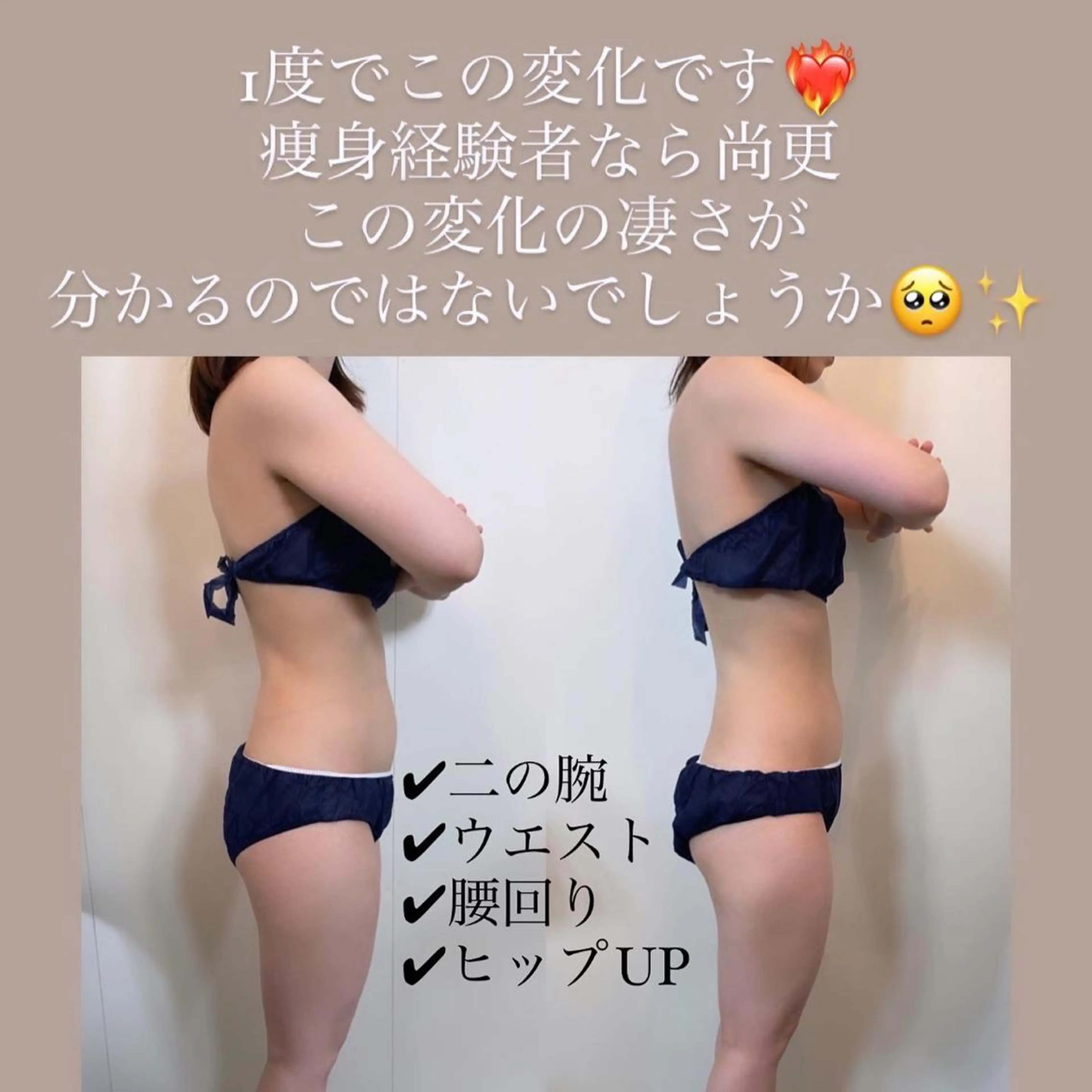 【🚨2ヶ月通い放題】痩身機器で全身はもちろん気になる部位も徹底ケア🔥理想のラインをつくりましょう💪の写真