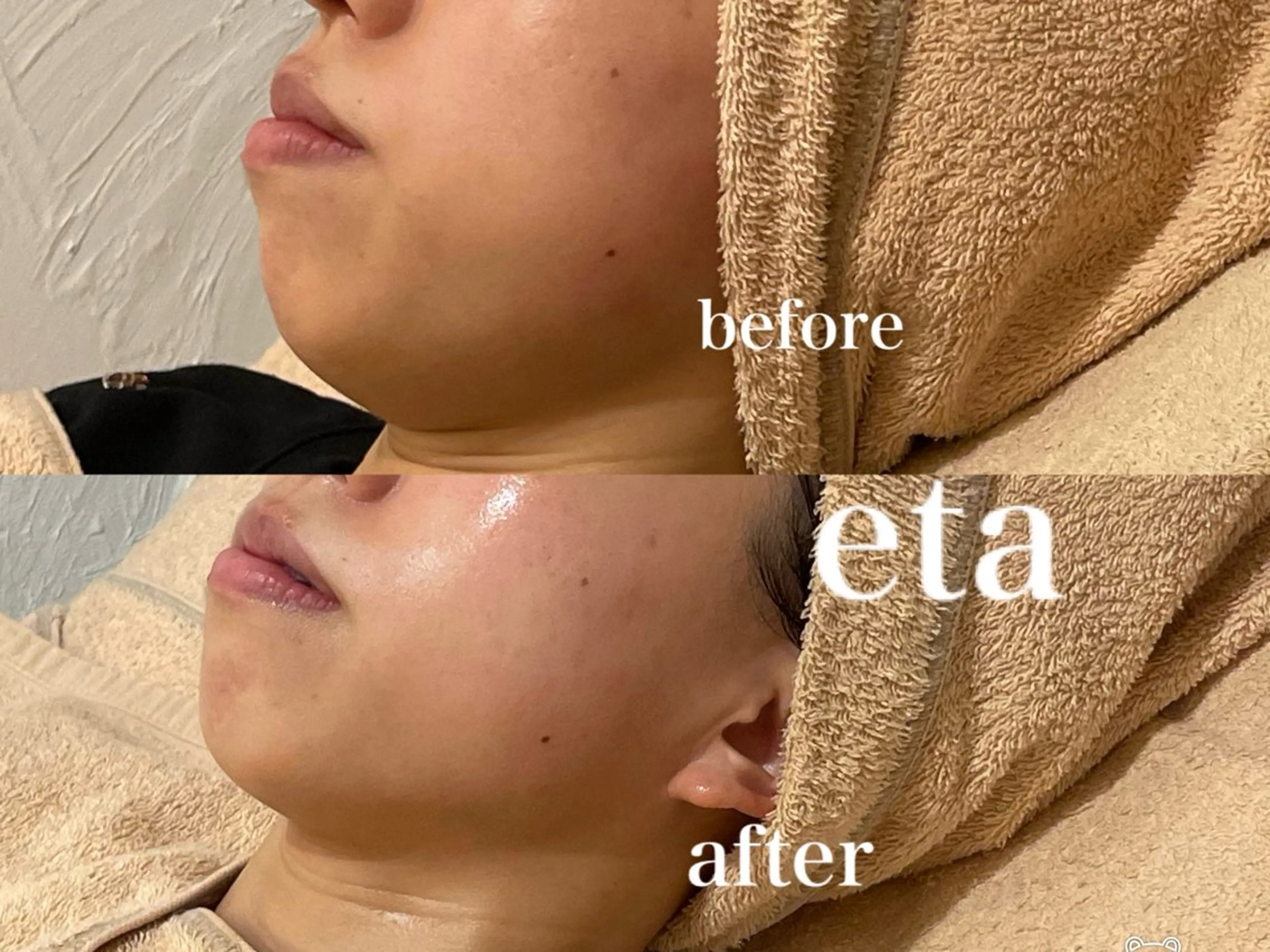 マツエク・マツパ エステ リラク 💋美ボディサロン eta【エタ】💋のエステ・リラクイメージ