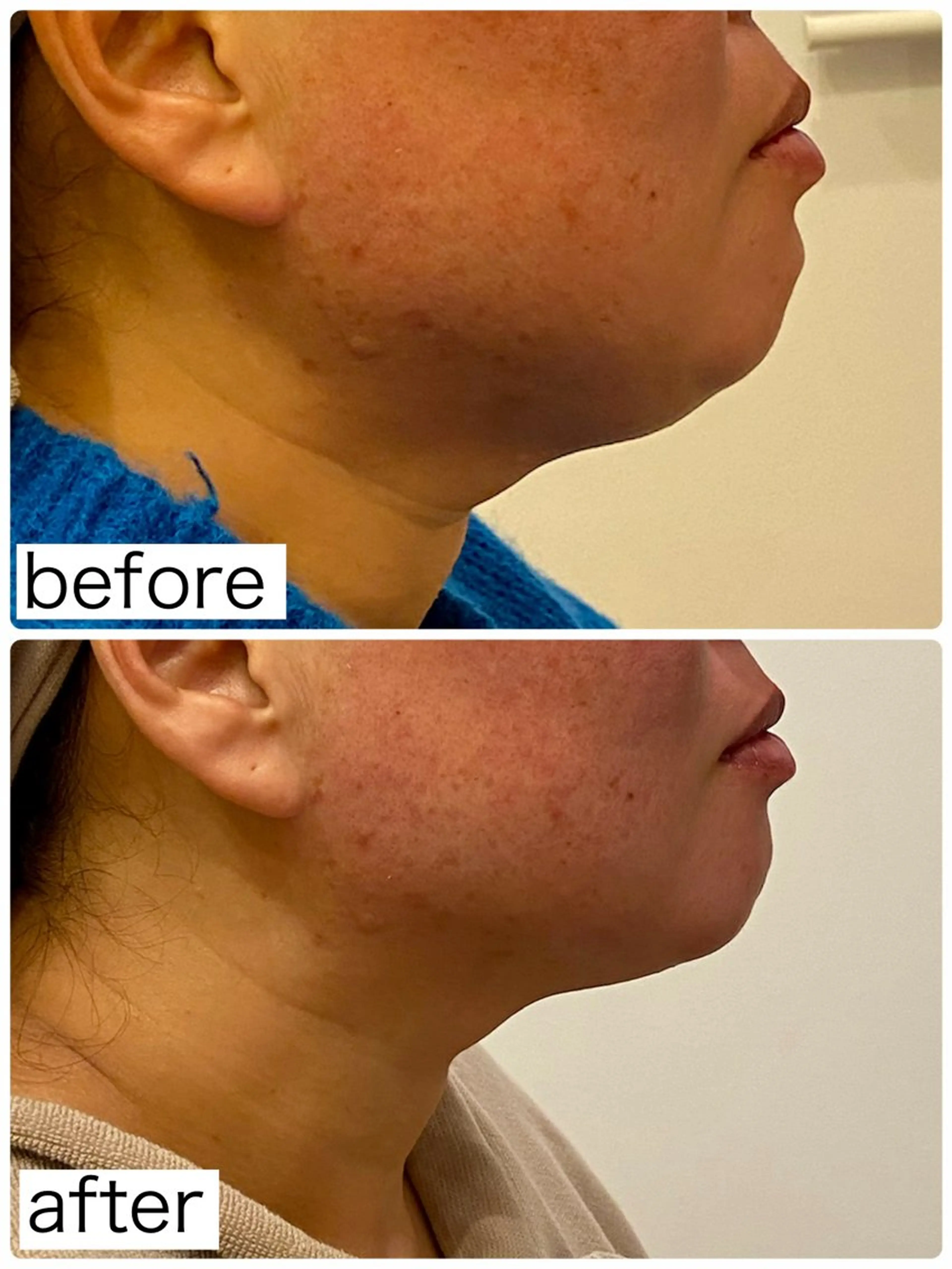 エステ Hisui 小出のエステ・リラクイメージ