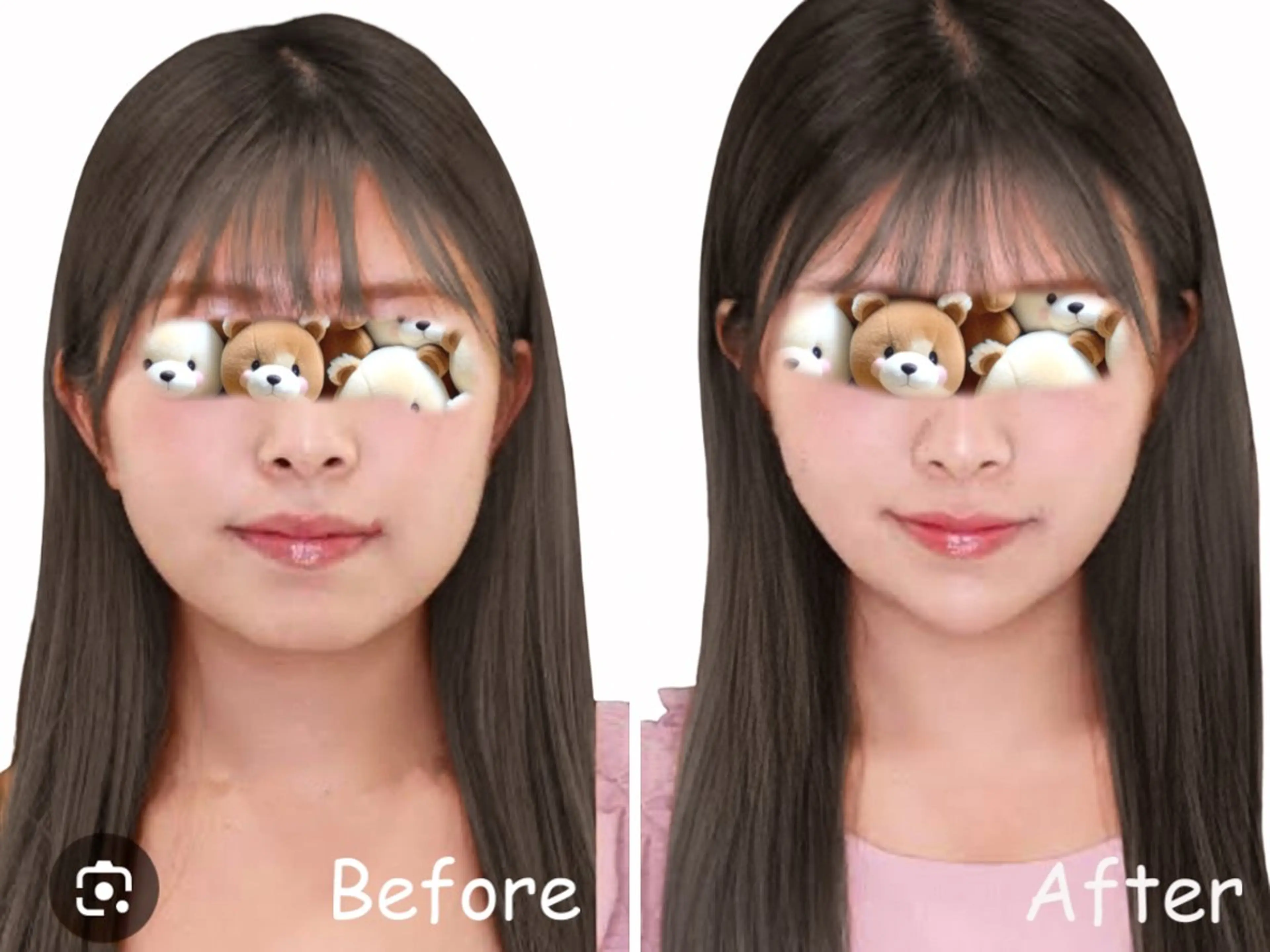 【歴13年】劇的小顔 D rマジックタッチのエステ・リラクイメージ