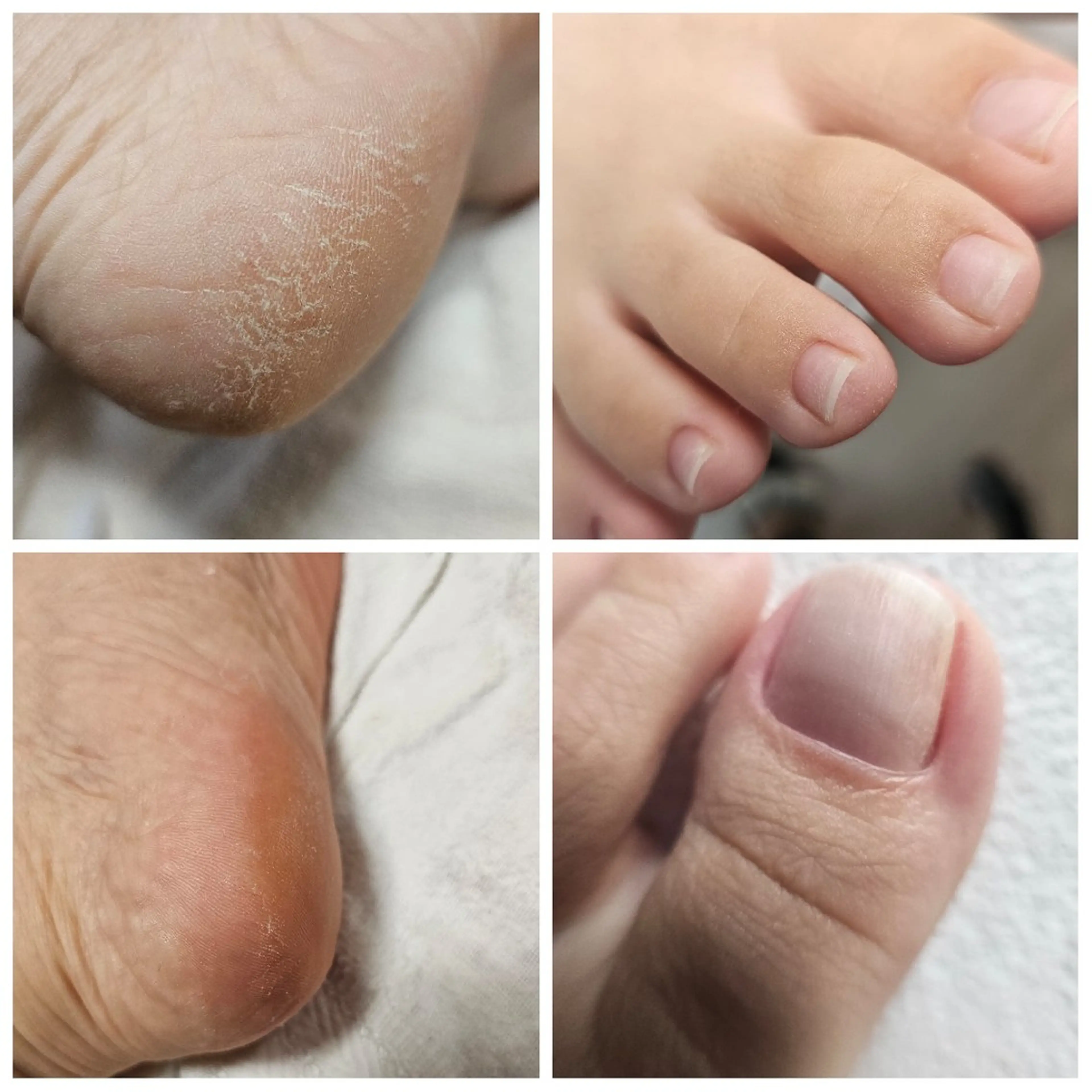 ♀️♂️🦶スパ♨️コース丁寧ケアジェルなし🚫[オフ込+20分スパ+足裏ディープクレンジング+足の裏の写真